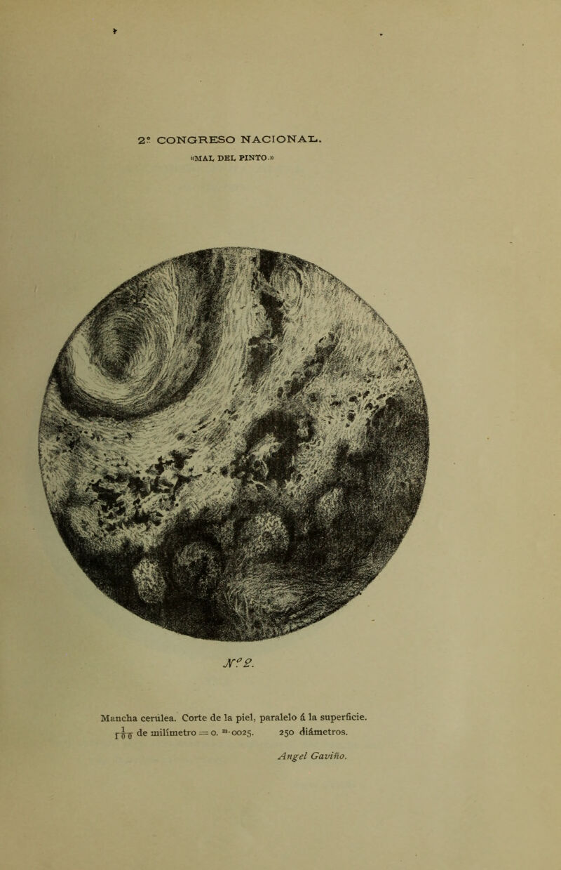 *• 2° CONGRESO NACIONAL. «MAL DEL PINTO » JT°2. Mancha cerúlea. Corte de la piel, paralelo á la superficie, de milímetro = o. “ ooas. 250 diámetros.