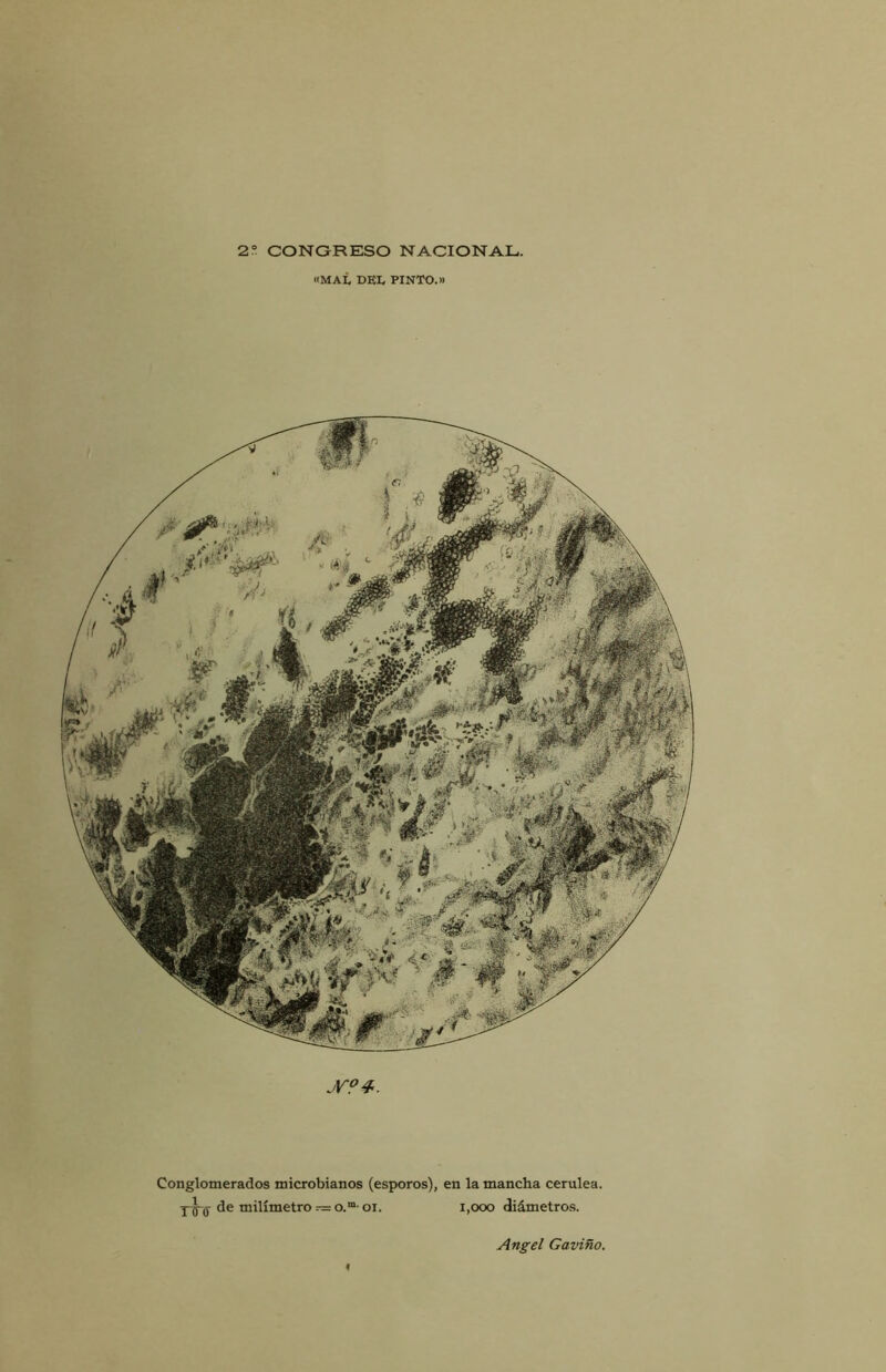 «MAL DEL PINTO.» jV0 4. Conglomerados microbianos (esporos), en la mancha cerúlea. TTd de milímetro — o.m' oí. 1,000 diámetros.