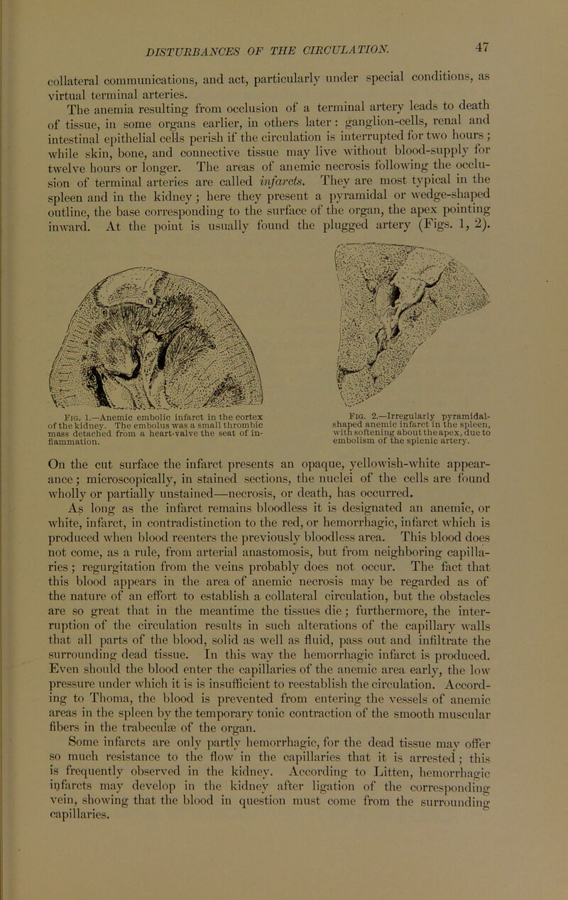collateral communications, and act, particularly under special conditions, as virtual terminal arteries. The anemia resulting from occlusion of a terminal artery leads to death of tissue, in some organs earlier, in others later : ganglion-cells, renal and intestinal epithelial cel-ls perish if the circulation is interrupted for two hours ; while skin, bone, and connective tissue may live without blood-supply for twelve hours or longer. The areas of anemic necrosis following the occlu- sion of terminal arteries are called infarcts. They are most typical in the spleen and in the kidney ; here they present a pyramidal or wedge-shaped outline, the base corresponding to the surface of the organ, the apex pointing inward. At the point is usually found the plugged artery (Figs. 1, 2). Fig. 1.—Anemic embolic infarct in the cortex of the kidney. The embolus was a small thrombic mass detached from a heart-valve the seat of in- flammation. Fig. 2.—Irregularly pyramidal- shaped anemic infarct in the spleen, with softening about the apex, due to embolism of the splenic artery. On the cut surface the infarct presents an opaque, yellowish-white appear- ance ; microscopically, in stained sections, the nuclei of the cells are found wholly or partially unstained—necrosis, or death, has occurred. A^ long as the infarct remains bloodless it is designated an anemic, or white, infarct, in contradistinction to the red, or hemorrhagic, infarct which is produced when blood reenters the previously bloodless area. This blood does not come, as a rule, from arterial anastomosis, but from neighboring capilla- ries ; regurgitation from the veins probably does not occur. The fact that this blood appears in the area of anemic necrosis may be regarded as of the nature of an effort to establish a collateral circulation, but the obstacles are so great that in the meantime the tissues die; furthermore, the inter- ruption of the circulation results in such alterations of the capillary walls that all parts of the blood, solid as well as fluid, pass out and infiltrate the surrounding dead tissue. In this way the hemorrhagic infarct is produced. Even should the blood enter the capillaries of the anemic area early, the low pressure under which it is is insufficient to reestablish the circulation. Accord- ing to Thoma, the blood is prevented from entering the vessels of anemic areas in the spleen by the temporary tonic contraction of the smooth muscular fibers in the trabecula? of the organ. Some infarcts are only partly hemorrhagic, for the dead tissue may offer so much resistance to the flow in the capillaries that it is arrested; this is frequently observed in the kidney. According to Litten, hemorrhagic infarcts may develop in the kidney after ligation of the corresponding vein, showing that the blood in question must come from the surrounding capillaries.