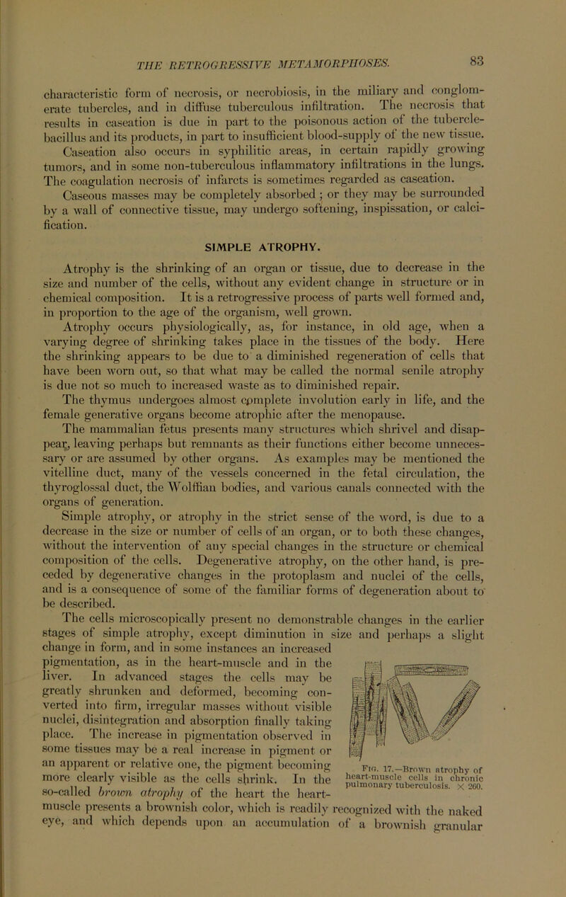 characteristic form of necrosis, or necrobiosis, in the miliary and conglom- erate tubercles, and in diffuse tuberculous infiltration. The necrosis that results in caseation is due in part to the poisonous action of the tubercle- bacillus and its products, in part to insufficient blood-supply of the new tissue. Caseation also occurs in syphilitic areas, in certain rapidly growing tumors, and in some non-tuberculous inflammatory infiltrations in the lungs. The coagulation necrosis of infarcts is sometimes regarded as caseation. Caseous masses may be completely absorbed y or they may be surrounded by a wall of connective tissue, may undergo softening, inspissation, or calci- fication. SIMPLE ATROPHY. Atrophy is the shrinking of an organ or tissue, due to decrease in the size and number of the cells, without any evident change in structure or in chemical composition. It is a retrogressive process of parts well formed and, in proportion to the age of the organism, well grown. Atrophy occurs physiologically, as, for instance, in old age, when a varying degree of shrinking takes place in the tissues of the body. Here the shrinking appears to be due to a diminished regeneration of cells that have been worn out, so that what may be called the normal senile atrophy is due not so much to increased waste as to diminished repair. The thymus undergoes almost complete involution early in life, and the female generative organs become atrophic after the menopause. The mammalian fetus presents many structures which shrivel and disap- pear, leaving perhaps but remnants as their functions either become unneces- sary or are assumed by other organs. As examples may be mentioned the vitelline duct, many of the vessels concerned in the fetal circulation, the thyroglossal duct, the Wolffian bodies, and various canals connected with the organs of generation. Simple atrophy, or atrophy in the strict sense of the word, is due to a decrease iu the size or number of cells of an organ, or to both these changes, without the intervention of any special changes in the structure or chemical composition of the cells. Degenerative atrophy, on the other hand, is pre- ceded by degenerative changes in the protoplasm and nuclei of the cells, and is a consequence of some of the familiar forms of degeneration about to be described. The cells microscopically present no demonstrable changes in the earlier stages of simple atrophy, except diminution in size and perhaps a slight change in form, and in some instances an increased pigmentation, as in the heart-muscle and in the liver. In advanced stages the cells may be greatly shrunken and deformed, becoming con- verted into firm, irregular masses without visible nuclei, disintegration and absorption finally taking place. The increase in pigmentation observed in some tissues may be a real increase in pigment or an apparent or relative one, the pigment becoming more clearly visible as the cells shrink. In the so-called brown atrophy of the heart the heart- muscle presents a brownish color, which is readily recognized with the naked eye, and which depends upon an accumulation of a brownish granular Fig. 17.—Brown atrophy of heart-muscle cells in chronic pulmonary tuberculosis, x 260.