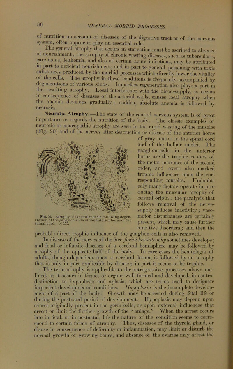 of nutrition on account of diseases of the digestive tract or of the nervous system, often appear to play an essential role. 1 lie general atrophy that occurs in starvation must be ascribed to absence of nourishment; the atrophy of chronic wasting diseases, such as tuberculosis, carcinoma, leukemia, and also of certain acute infections, may be attributed in pait to deficient nourishment, and in part to general poisoning with toxic substances produced by the morbid processes which directly lower the vitality of the cells. The atrophy in these conditions is frequently accompanied by degenerations of various kinds. Imperfect regeneration also plays a part in the lesulting atrophy. Local interference with the blood-supply, as occurs in consequence of diseases of the arterial walls, causes local atrophy when the anemia develops gradually; sudden, absolute anemia is followed by necrosis. Neurotic Atrophy.— The state of the central nervous system is of great importance as regards the nutrition of the body. The classic examples of neuiotic or neuropathic atrophy are seen in the rapid wasting of the muscles (Fig. 20) and of the nerves after destruction or disease of the anterior horns of gray matter in the spinal cord and of the bulbar nuclei. The ganglion-cells in the anterior horns are the trophic ceutei’s of the motor neurones of the second order, and exert also marked trophic influences upon the cor- responding muscles. Undoubt- edly many factors operate in pro- ducing the muscular atrophy of central origin : the paralysis that follows removal of the nerve- supply induces inactivity; vaso- motor disturbances are certainly V present, which may cause further nutritive disorders; and then the probable direct trophic influence of the ganglion-cells is also removed. In disease of the nerves of the face facial hemiatrophy sometimes develops ; and fetal or infantile diseases of a cerebral hemisphere may be followed by atrophy of the opposite half of the body. In rare cases the hemiplegia of adults, though dependent upon a cerebral lesion, is followed by an atrophy that is only in part explicable by disuse; in part it seems to be trophic. The term atrophy is applicable to the retrogressive processes above out- lined, as it occurs in tissues or organs well formed and developed, in contra- distinction to hypoplasia and aplasia, which are terms used to designate imperfect developmental conditions. Hypoplasia, is the incomplete develop- ment of a part of the body. Growth may be arrested during fetal life or during the postnatal period of development. Hypoplasia may depend upon causes originally present in the germ-cells, or upon external influences that arrest or limit the further growth of the “anlage.” When the arrest occurs late in fetal, or in postnatal, life the nature of the condition seems to corre- spond to certain forms of atrophy. Thus, diseases of the thyroid gland, or disuse in consequence of deformity or inflammation, may limit or disturb the normal growth of growing bones, and absence of the ovaries may arrest the Fig. 20.—Atrophy of skeletal muscle following degen- eration of the ganglion-cells of the anterior horns of the spinal cord. X 175.