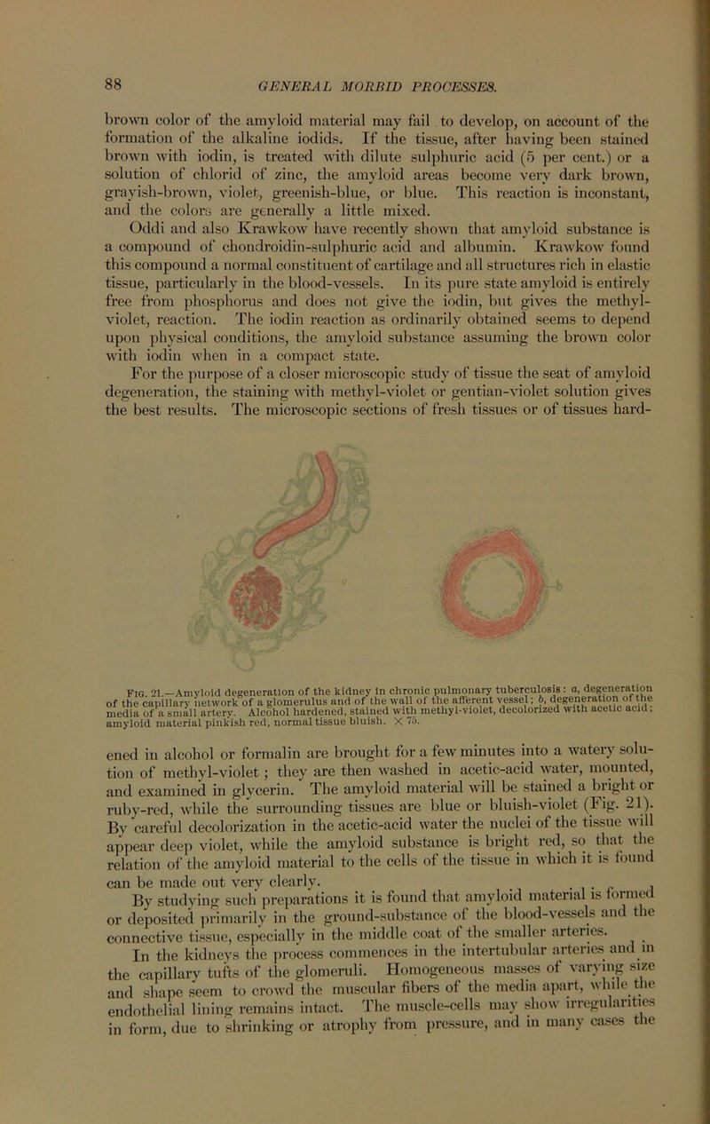 brown color of the amyloid material may fail to develop, on account of the formation of the alkaline iodids. If the tissue, after having been stained brown with iodin, is treated with dilute sulphuric acid (5 per cent.) or a solution of chlorid of zinc, the amyloid areas become very dark brown, grayish-brown, violet, greenish-blue, or blue. This reaction is inconstant, and the colors are generally a little mixed. Oddi and also Krawkow have recently shown that amyloid substance is a compound of chondroidin-sulphuric acid and albumin. Krawkow found this compound a normal constituent of cartilage and all structures rich in elastic tissue, particularly in the blood-vessels. In its pure state amyloid is entirely free from phosphorus and does not give the iodin, but gives the methyl- violet, reaction. The iodin reaction as ordinarily obtained seems to depend upon physical conditions, the amyloid substance assuming the brown color with iodin when in a compact state. For the purpose of a closer microscopic study of tissue the seat of amyloid degeneration, the staining with methyl-violet or gentian-violet solution gives the best results. The microscopic sections of fresh tissues or of tissues hard- Fig 21 —Amyloid degeneration of the kidney in chronic pulmonary tuberculosis : a, degeneration of the capillary network of a glomerulus and of the wall of the afferent vessel; ^Regeneration of the media of a small artery. Alcohol hardened, stained with methyl-violet, decolorized with acetic acid, amyloid material pinkish red, normal tissue bluish. X 75. ened iu alcohol or formalin are brought for a few minutes into a watery solu- tion of methyl-violet; they are then washed in acetic-acid water, mounted, and examined in glycerin. The amyloid material will be stained a blight or ruby-red, while the surrounding tissues are blue or bluish-violet (Fig. 21). By careful decolorization in the acetic-acid water the nuclei of the tissue will appear deep violet, while the amyloid substance is bright red, so that the relation of the amyloid material to the cells of the tissue in which it is found can be made out very clearly. _ , By studying such preparations it is found that amyloid material is iormec or deposited primarily in the ground-substance of the blood-vessels and t le connective tissue, especially in the middle coat of the smaller aiteiies. In the kidneys the process commences in the intertubular arteries and m the capillary tufts of the glomeruli. Homogeneous masses of varying size and shape seem to crowd the muscular fibers of the media apart, while the endothelial lining remains intact. The muscle-cells may show irregularities in form, due to shrinking or atrophy from pressure, and in many cases the