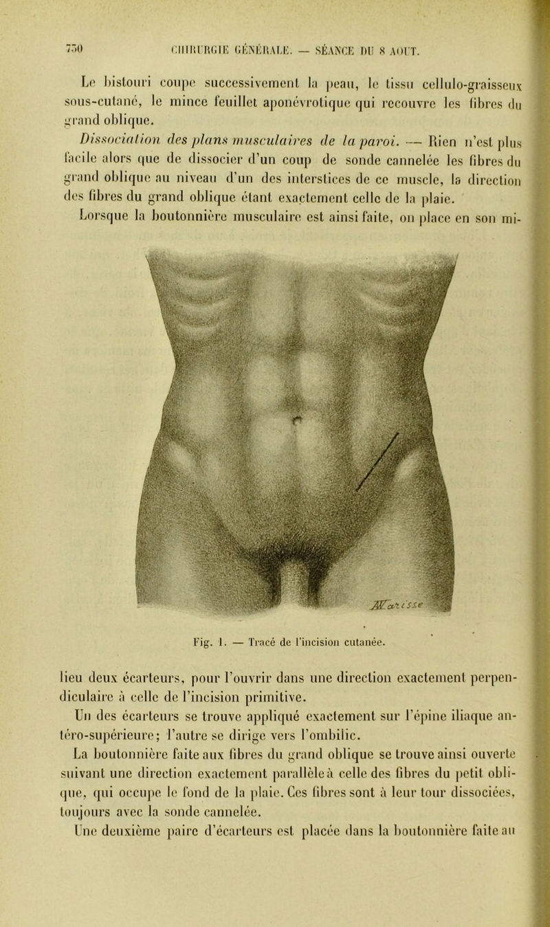 /•O ciiiiu Ftcii': (;i;m;uai,m. — seakck iuî s aoi t. Lo hislomi coti|)(‘ siicccssiveinenl l<i potiii, h; lissii cdliilo-gi’aissciix smis-culaiK!, le mince ieuillol aponévrolique qui recouvre les libres du ^l'iuid oblifpie. Dissociation des plans invsculaires de la paroi. — Rien n’esl plus Incile alors ((ue de dissocier d’un coup de sonde cannelée les fibres du grand oblique au niveau d’un des interstices de ce muscle, la direction des fibres du grand oblique étant exactement celle de la plaie. Loi'sque la boutonnière musculaire est ainsi faite, on |dace en son mi- Fig-. 1. — Tracé de l’incision cutanée. lieu deux écarteurs, pour l’ouvrir dans une direction exactement perpen- diculaire à celle de l’incision primitive. Un des écarteurs se trouve ap|)liqué exactement sur l’épine iliaque an- téro-supérieure; l’autre se dirige vers l’ombilic. La boutonnière faite aux libres du grand oblique se trouve ainsi ouverte suivant une direction exactement parallcleà celle des fibres du petit obli- (]ue, qui occupe le fond de la plaie. Ces fibres sont à leur tour dissociées, toujours avec la sonde cannelée. UiK! deuxième |)airc d’écarteurs est placée dans la boutonnière faite au