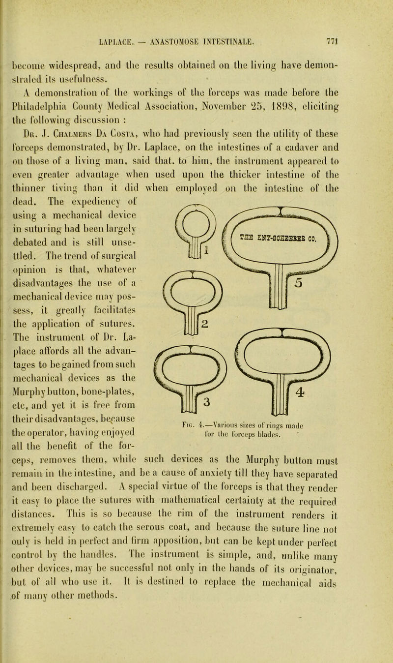 Itccolue widespread, and llio results obtained on tlic living liave demon- slraled ils usi'fidncss. A deinonstfation of llie workings of tlio forceps was madc before the I Pbiladelpbia Coiinty Medical Association, Noveinber !25, 1808, eliciting the following discussion ; Du. .1. Cn.vi.MERs Da Costa, wlio had pcevioiisly scen the ntilily of these forceps demonsiraled, by Dr. Laplace, on the intestines of a cadaver and on tbose of a living man, said that. to hiin, tlie instrument a|>peared to even greater advantage vvlien used upon tbe tliicker intestine of the i tbinner tiving tban it did wlien einployed on the intestine of the dead. The expediency of using a meclianical device ; in sutut ing had been largely debated and is still unse- ! ttled. The frend of surgical opinion is that, whatever , disadvantages the use of a ! meclianical device niay pos- I sess, it greally facilitâtes I the application of sutures. The instrument of Dr. La- « place alfords ail the advan- I tages to be gained from snch : meclianical devices as the I Murphy button, bone-plates, I etc, and yet it is free from ; their disadvantages, ber.ause I the opérator, having enjoyed I ail the benefit of the for- I ceps, renioves llieni, xvhile such devices as the Murphy button niust I reinain in the intestine, and be a cause of anxiety till they bave separated I and been disebarged. A spécial virtue of the forceps is that they render it easy to place the sutures witli mathematical certainty at the required distances. This is so because the rim of the instrument rendors it ; cxtremely easy to catch the serons coat, and because the suture line iiot I ouly is held in perfect and (irm apposition, but can be keptunder perfect I control by the haiidles. The instrument is simple, and, uniike many I otlier devices, may be successful not only in the hands of its originator, but of ail xvbo use it. It is destined to replace the meclianical aids of many other methods. Fig. 4.—Varions sizes of rings mado for llic forceps blades.