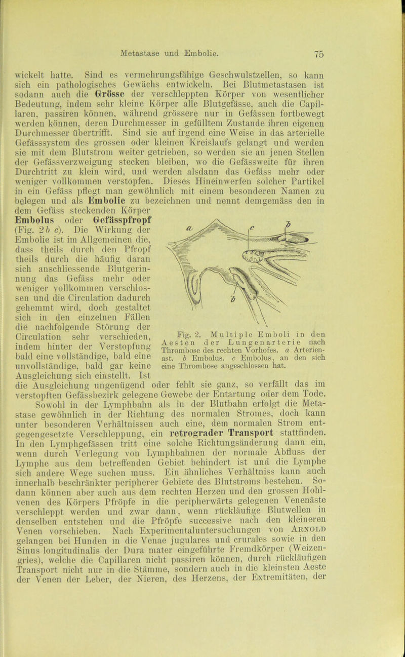 t t f ! i I i 7 I f : I wickelt hatte. Sind es vennehrungsfähige Geschwulstzellen, so kann sich ein pathologisches Gewächs entwickeln. Bei Blutnietastasen ist sodann auch die Grösse der verschleppten Körper von wesentlicher Bedeutung, indem sehr kleine Körper alle Blutgefässe, auch die Capil- laren, passiren können, während grössere nur in Gefässen fortbewegt werden können, deren Durchmesser in gefülltem Zustande ihren eigenen Durchmesser übertrifft. Sind sie auf irgend eine Weise in das arterielle Gefässsystem des grossen oder kleinen Kreislaufs gelangt und werden sie mit dem Blutstrom weiter getrieben, so werden sie an jenen Stellen der Gefässverzweigung stecken bleiben, wo die Gefässweite für ihren Durchtritt zu klein wird, und werden alsdann das Gefäss mehr oder weniger vollkommen verstopfen. Dieses Hineinwerfen solcher Partikel in ein Gefäss pflegt man gewöhnlich mit einem besonderen Namen zu belegen und als Embolie zu bezeichnen und nennt demgemäss den in dem Gefäss steckenden Körper Embolus oder Gefiisspfropf (Fig. 2 h c). Die Wirkung der Embolie ist im Allgemeinen die, dass theils durch den Pfropf theils durch die häufig daran sich anschliessende Blutgerin- nung das Gefäss mehr oder weniger vollkommen verschlos- sen und die Circulation dadurch gehemmt wird, doch gestaltet sich in den einzelnen Fällen die nachfolgende Störung der Circulation sehr verschieden, indem hinter der Verstopfung bald eine vollständige, bald eine unvollständige, bald gar keine Ausgleichung sich einstellt. Ist die Ausgleichung ungenügend oder fehlt sie ganz, so verfällt das im verstopften Gefässbezirk gelegene Gewebe der Entartung oder dem Tode. Sowohl in der Lymphbahn als in der Blutbahn erfolgt die Meta- stase gewöhnlich in der Richtung des normalen Stromes, doch kann unter besonderen Verhältnissen auch eine, dem normalen Strom ent- gegengesetzte Verschleppung, ein retrogTader Transport stattfinden. In den Lymphgefässen tritt eine solche Richtungsänderung dann ein, wenn durch Verlegung von Lymphbahnen der normale Abfluss der Lymphe aus dem betreffenden Gebiet behindert ist und die Lymphe sich andere Wege suchen muss. Ein ähnliches \erhältniss kann auch innerhalb beschränkter peripherer Gebiete des Blutstronis bestehen. So- dann können aber auch aus dem rechten Herzen und den grossen Hohl- venen des Körpers Pfröpfe in die peripherwärts gelegenen Venenäste verschleppt werden und zwar dann, wenn rückläufige Blutwellen in denselben entstehen und die Pfrö])fe successive nach den kleineren Venen vorschieben. Nach Experimentaluntersuchungen von Arnold gelangen bei Hunden in die Venae jugulares und crurales sowie in den Sinus longitudinalis der Dura mater eingeführte Fremdkör])er (Weizen- gries), welche die Capillaren nicht passiren können, durch rückläufigen Transport nicht nur in die Stämme, sondern auch in die kleinsten Aeste der Venen der Leber, der Nieren, des Herzens, der Extremitäten, dei Fig. 2. Multiple Emboli in den Aesten der Lungenarterie nach Thrombose des rechten Vorhofes, a Arterien- ast. b Embolus, e Embolus, an den sich eine Thrombose angeschlossen hat. i