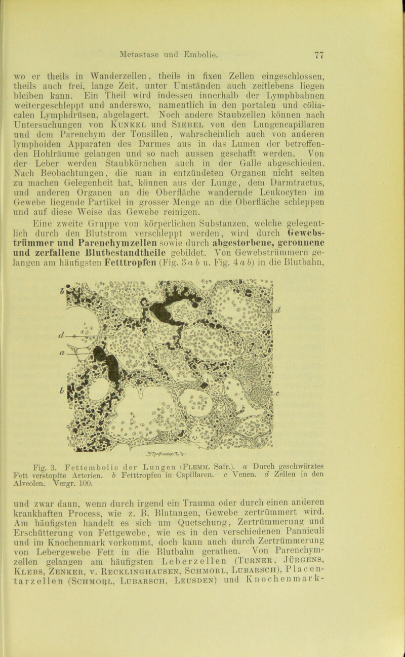 Avo er tlieils in Wamlerzellen, tlieils in fixen Zellen eingeschlossen, theils auch frei, lange Zeit, unter Umständen auch zeitlebens liegen bleiben kann. Ein Theil wird indessen innerhalb der Lymphbahnen weitergeschlepiit und anderswo, namentlich in den portalen und cölia- calen Lymphdrüsen. abgelagert. Noch andere Staubzellen können nach Untersuchungen von Kunkel und Siebel von den Lungencapillaren und dem Parenchym der Tonsillen, wahrscheinlich auch von anderen lymphoiden Apparaten des Darmes aus in das Lumen der betreffen- den Hohlränme gelangen und so nach aussen geschafft werden. Von der Leber werden Staultkörnchen auch in der Galle abgeschieden. Nach Beobachtungen, die man in entzündeten Organen nicht selten zu machen Gelegenheit hat, können aus der Lunge, dem Darmtractus, und anderen Organen an die Oberfläche wandernde Leukocyten im Gewebe liegende Partikel in grosser Menge an die Oberfläche schleppen und auf diese Weise das Gewebe reinigen. Eine zweite Gruppe von körperlichen Substanzen, welche gelegent- lich durch den Blutstrom verschleppt werden, wird durch Gewebs- trümmer und Pareiichymzellen sowie durch abgestorbene, geronnene und zerfallene Blutbcstandtheile gebildet. Von Gewebstrümmern ge- langen am häufigsten Fetttropfen (Fig. 'dab u. Fig. 4ab) in die Blutbahn, Fig. 3. Fettembolie der Lungen (Flemm. Safr.). a Durch geschwärztes Fett verstopfte Arterien, b Fetttropfen in Capillaren. c Venen, d Zellen in den Alveolen. Vergr. 100. und zwar dann, wenn durch irgend ein Trauma oder durch einen anderen krankhaften Process, wie z. B. Blutungen, Gewebe zertrümmert wird. Am häufigsten handelt es sich um Quetschung, Zertrümmerung und Erschütterung von Fettgewebe, wie es in den verschiedenen Panniculi und im Knochenmark vorkommt, doch kann auch durch Zertrümmerung von Lebergewebe Fett in die Blutbahn gerathen. Von Pareiichym- zellen gelangen am häufigsten Leberzellen (Turner, .Iürgens, Klebs, Zenker, v. Recklinghausen, Schmorl, Lubarsch), Placen- tarzellen (Schmorl, Lubarsch, Leusden) und Knochenmark-