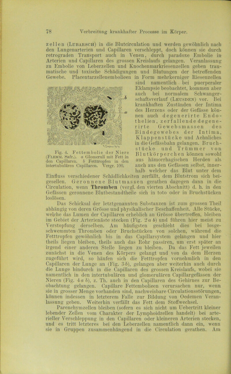 zellen (Lubarsch) in die Bliitcircnlation und werden gewöhnlich nach den Lungenarterien und Capillaren verschlej)pt, doch können sie durch retrograden Transport auch in Venen, durch ])aradoxe Embolie in Arterien und Capillaren des grossen Kreislaufs gelangen. Veranlassung zu Embolie von Leberzellen und Knochenmarkriesenzellen geben trau- matische und toxische Schädigungen und Blutungen der betreffenden Gewebe. Placentarzellenembolieen in Form mehrkerniger Riesenzellen sind namentlich bei puerperaler Eklampsie beobachtet, kommen aber auch bei normalem Schwanger- schaftsverlauf (LeusdenJ vor. Bei krankhaften Zu.ständen der Intima des Herzens oder der Gefässe kön- nen auch degenerirte Endo- thelien, zerfallende degene- rirte G e w e b s in a s s e n des Bindegewebes der Intima, Klappen stücke und Aehnliches in dieGefässbahn gelangen. Bruch- stücke u n d T r ü m m e r von Blutkörperchen können sowohl ans hämorrhagischen Herden als auch aus den Gefässen selbst, inner- halb welcher das Blut unter dem Einfluss verschiedener Schädlichkeiten zerfällt, dem ßlutstrom sich bei- gesellen. Geronnene Blutmassen gerathen dagegen dann in die Circulation, wenn Throiiibeii (vergl. den vierten Abschnitt) d. h. in den Gefässen geronnene Blutbestaudtheile sich in toto oder in Bruchstücken loslösen. Das Schicksal der letztgenannten Substanzen ist zum grossen Theil abhängig von deren Grösse und physikalischer Beschaffenheit. Alle Stücke, welche das Lumen der Capillaren erheblich an Grösse übertreffen, bleiben im Gebiet der Arterienäste stecken (Fig. 2 a b) und führen hier meist zu Verstopfung derselben. Am häufigsten geschieht dies bei losge- schwemmten Thromben oder Bruchstücken von solchen, während die Fetttropfen gewöhnlich bis in das Capillarsystem gelangen und hier theils liegen bleiben, theils auch das Rohr passiren, um erst später an irgend einer anderen Stelle liegen zu bleiben. Da das Fett jeweilen zunächst in die Venen des Körpers gelangt und von da dem Herzen zugeführt wird, so häufen sich die Fetttropfen vornehmlich in den Capillaren der Lunge an (Fig. 3 h), gelangen aber weiterhin auch durch die Lunge hindurch in die Capillaren des grossen Kreislaufs, wobei sie namentlich in den intertubulären und glomerulären Capillargefüssen der Nieren (Fig. 4«b), z. Th. auch in den Capillaren des Gehirnes zur Be- obachtung gelangen. Capillare Fettembolieon verursachen nur, wenn sie in grosser Menge voihanden sind, nachweisbare Circulationsstörungen, können indessen in letzterem Falle zur Bilduug von Oedemen Veran- lassung geben. Weiterhin verfällt das Fett dem Stoffwechsel. Parenchymzellen l)leiben (sofern es sich nicht um Uebertritt kleiner lebender Zellen vom Charakter der Lymphoidzellen handelt) bei arte- rieller Verscblep])ung in den Capillaren oder kleineren Arterien stecken, und es tritt letzteres bei den liOberzellen namentlich dann ein, wenn sie in Gru])pen zusammenhängend in die Circulation gerathen. Am Fig. 4. Fettembolie der Niere (Flemm. öafr.). a GlomeruH mit Fett in den Capillaren. b Fetttropfeu in den intertubnlären Capillaren. Vergr. 100.