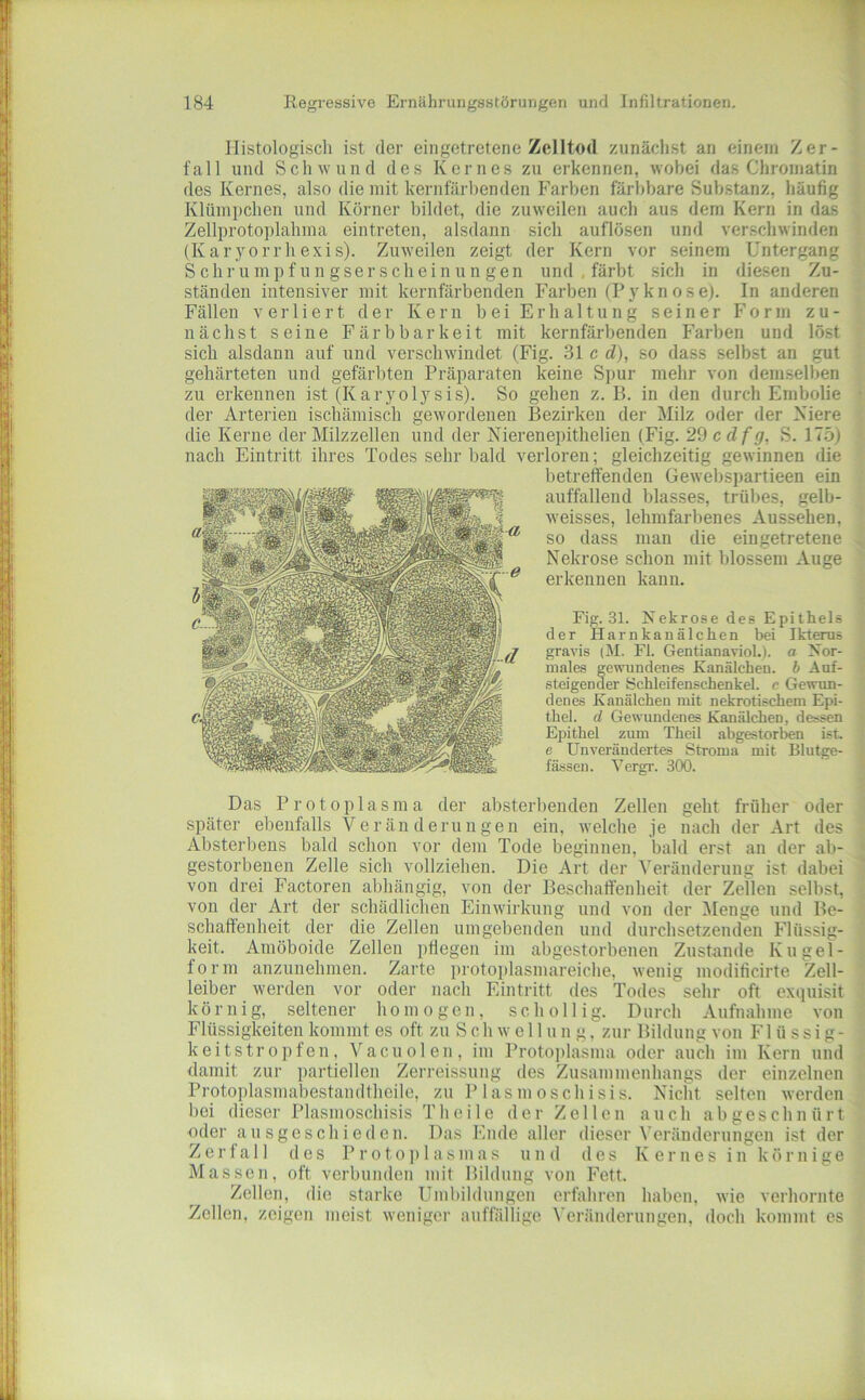Histologisch ist der eingetretene Zelltod zunächst an einem Zer- fall und Schwund des Kernes zu erkennen, wobei das Chromatin des Kernes, also die mit kernfärhenden Farben färbbare Substanz, häufig Klümjtchen und Körner bildet, die zuweilen auch aus dem Kern in das Zellproto])lahma eintreten, alsdann sich auflösen und verschwinden (Karyorrhexis). Zuweilen zeigt der Kern vor seinem Untergang Schrumpfungserscheinungen und , färbt sich in diesen Zu- ständen intensiver mit kernfärbenden Farben (Pyknose). In anderen Fällen verliert der Kern bei Erhaltung seiner Form zu- nächst seine Färbbarkeit mit kernfärbenden Farben und löst sich alsdann auf und verschwindet (Fig. 2>l c d), so dass selbst an gut gehärteten und gefärbten Präparaten keine Spur mehr von dem.selben zu erkennen ist (Karyolysis). So gehen z. B. in den durch Embolie der Arterien ischämisch gewordenen Bezirken der Milz oder der Kiere die Kerne der Milzzellen und der Nierenepithelien (Fig. 29 cdfg, S. 175) nach Eintritt ihres Todes sehr bald verloren; gleichzeitig gewinnen die betreffenden Gewebspartieen ein auffallend blasses, trübes, gelb- weisses, lehmfarbenes Aussehen, so dass man die eingetretene Nekrose schon mit blossem Auge erkennen kann. Fig. 31. Nekrose des Epithels der Harnkanälchen bei Ikterus gravis (i\l. Fl. GentlanavioL). a Nor- males gewundenes Kanälchen, b Auf- steigender öchleifenschenkel. c Gewun- denes Kanälchen mit nekrotischem Epi- thel. d Gewundenes Kanälchen, dessen E2Jithel zum Theil abgestorben ist. e Unverändertes Stroma mit Blutge- fässen. Vergr. 300. Das Protoplasma der absterbenden Zellen geht früher oder später ebenfalls Veränderungen ein, welche je nach der Art des Absterbens bald schon vor dem Tode beginnen, bald erst an der ab- gestorbenen Zelle sich vollziehen. Die Art der Veränderung ist dabei von drei Factoren abhängig, von der Beschaffenheit der Zellen selbst, von der Art der schädlichen Einwirkung und von der Menge und Be- schaffenheit der die Zellen umgebenden und durchsetzenden Flüssig- keit. Amöboide Zellen ptlegen im abgestorbenen Zustande Kugel- form anzunehmen. Zarte protoplasmareiche, wenig modificirte Zell- leiber werden vor oder nach Eintritt des Todes sehr oft exquisit körnig, seltener homogen, schollig. Durch Aufnahme von Flüssigkeiten kommt es oft zu Schwe 11 un g, zur Bildung von Flüssig- keitstropfen, Vacnolen, im Proto])lasma oder auch im Kern und damit zur partiellen Zerreissnng des Zusammenhangs der einzelnen Protoplasmabestandtheile, zu Plasmoschisis. Nicht selten werden bei dieser Plasmoschisis Th eile der Zellen auch ab geschnürt oder ausgeschie(1 en. Das Ende aller dieser Veränderungen ist der Zerfall des Proto])lasmas und des Kernes in körnige Massen, oft verbunden mit Bildung von P^ett. Zellen, die starke Umbildungen erfahren haben, wie verhornte Zellen, zeigen meist weniger auffällige ^■eränderungen, doch kommt es