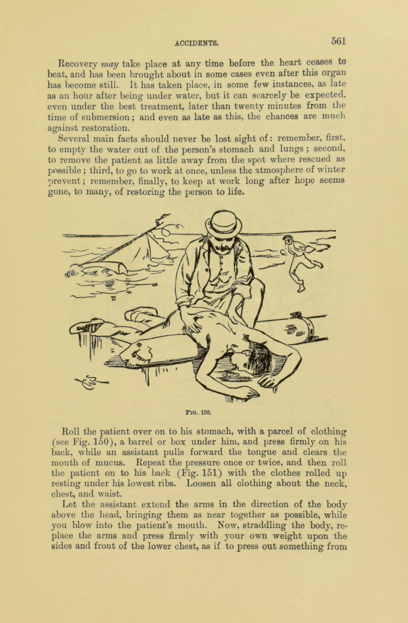 Recovery may take place at any time before the heart ceases to beat, and has been brought about in some cases even after this organ has become still. It has taken place, in some few instances, as late as an hour after being under water, but it can scarcely be expected, even under the best treatment, later than twenty minutes from the time of submersion; and even as late as this, the chances are much against restoration. Several main facts should never be lost sight of: remember, first, to empty the water out of the person’s stomach and lungs ; second, to remove the patient as little away from the spot where rescued as possible ; third, to go to work at once, unless the atmosphere of winter prevent; remember, finally, to keep at work long after hope seems gone, to many, of restoring the person to life. Fig. 150. Roll the patient over on to his stomach, with a parcel of clothing (see Fig. 150), a barrel or box under him, and press firmly on his back, while an assistant pulls forward the tongue and clears the mouth of mucus. Repeat the pressure once or twice, and then roll the patient on to his back (Fig. 151) with the clothes rolled up resting under his lowest ribs. Loosen all clothing about the neck, chest, and waist. Let the assistant extend the arms in the direction of the body above the head, bringing them as near together as possible, while you blow into the patient’s mouth. Now, straddling the body, re- place the arms and press firmly with your own weight upon the sides and front of the lower chest, as if to press out something from