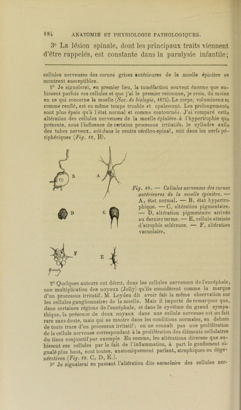 3° La lésion spinale, dont les principaux traits viennent d’être rappelés, est constante dans la paralysie infantile; cellules nerveuses des cornes grises antérieures de la moelle épinière se montrent susceptibles. 1° Je signalerai, en premier lieu, la tuméfaction souvent énorme que su- bissent parfois ces cellules et que j'ai le premier reconnue, je crois, du moins en ce qui concerne la moelle [Soc. de biologie, 1872). Le corps, volumineux et comme renflé, est en même temps trouble et opalescent. Les prolongements sont plus épais qu’à l'état normal et comme contournés. J’ai comparé cette altération des cellules nerveuses de la moelle épinière à l’hypertrophie que présente, sous l’influence de certains processus irritatifs, le cylindre axile des tubes nerveux, soitdans le centre cérébro-spinal, soit dans les nerfs pé- riphériques {Fig. 70, B). Fig. 70.— Cellules nerveuses des cornes antérieures de la moelle épinière. — A, état normal. — B, état hj'pertro- phique. — C, altération pigmentaire. — D, altération pigmentaire arrivée au dernier terme. — E, cellule atteinte d’atrophie scléreuse. — F, altération vacuolaire. 2° Quelques auteurs ont décrit, dans les cellules nerveuses de l'encéphale, une multiplication des noyaux (Jolly) qu’ils considèrent comme la marque d’un processus irritatif. M. Leyden dit avoir fait la même observation sur les cellules ganglionnaires de la moelle. Mais il importe de remarquer que, dans certaines régions de l’encéphale, et dans le système du grand sympa- thique, la présence de deux noyaux dans une cellule nerveuse est un fait rare sans doute, mais qui se montre dans les conditions normales, en dehors de toute trace d’un processus irritatif ; on ne connaît pas une prolifération de la cellule nerveuse correspondant à la prolifération des éléments cellulaires du tissu conjonctif par exemple En somme, les altérations diverses que su- bissent ces cellules par le fait de l’inflammation, à part le gonflement si- gnalé plus haut, sont toutes, anatomiquement parlant, atrophiques ou dégé- nératives {Fig. 70, G, D, E.). 3° Je signalerai en passant l’altération dite vacuolaire des cellules ner-