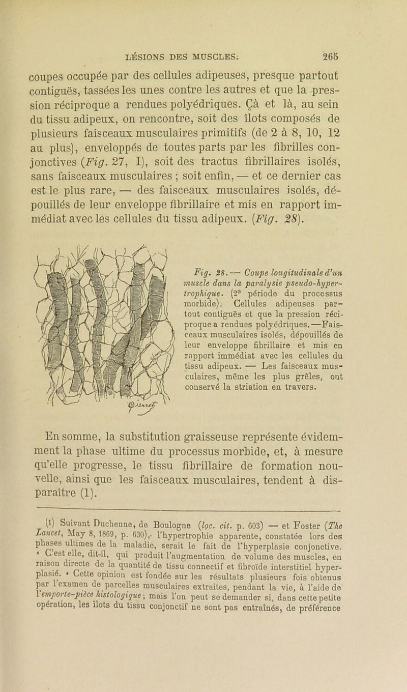 coupes occupée par des cellules adipeuses, presque partout contiguës, tassées les unes contre les autres et que la pres- sion réciproque a rendues polyédriques. Çà et là, au sein du tissu adipeux, on rencontre, soit des îlots composés de plusieurs faisceaux musculaires primitifs (de 2 à 8, 10, 12 au plus), enveloppés de toutes parts par les fibrilles con- jonctives {Fig. 27, I), soit des tractus lîbrillaires isolés, sans faisceaux musculaires ; soit enfin, — et ce dernier cas est le plus rare, — des faisceaux musculaires isolés, dé- pouillés de leur enveloppe fibrillaire et mis en rapport im- médiat avec les cellules du tissu adipeux. [Fig. 28). Fig. 28.— Coupe longitudinale d’un muscle dans la paralysie pseudo-hyper- trophique. (2° période du processus morbide). Cellules adipeuses par- tout contiguës et que la pression réci- proque a rendues polyédriques.—Fais- ceaux musculaires isolés, dépouillés de leur enveloppe fibrillaire et mis en rapport immédiat avec les cellules du tissu adipeux. — Les faisceaux mus- culaires, même les plus grêles, ont conservé la striation en travers. En somme, la substitution graisseuse représente évidem- ment la phase ultime du processus morbide, et, à mesure qu’elle progresse, le tissu fibrillaire de formation nou- velle, ainsi que les faisceaux musculaires, tendent à dis- paraître (1). (l) Suivant Duchenne, de Boulogne (Iqc. cit. p. 003) — et Foster (The Lancet, May 8, 1809, p. 630),- l’bypertrophie apparente, constatée lors des phases ultimes de la maladie, serait le fait de l'hyperplasie conjonctive. * . es^ e^e» dit-il, qui produit l’augmentation de volume des muscles, en raison directe de la quantité de tissu connectif et fibroïdo interstitiel hyper- plasié. » Cette opinion est fondée sur les résultats plusieurs fois obtenus par 1 examen de parcelles musculaires extraites, pendant la vie, à l’aide de 1 emportc-pièce histologique \ mais l’on peut se demander si, dans cette petite opération, les îlots du tissu conjonctif ne sont pas entraînés, de préférence