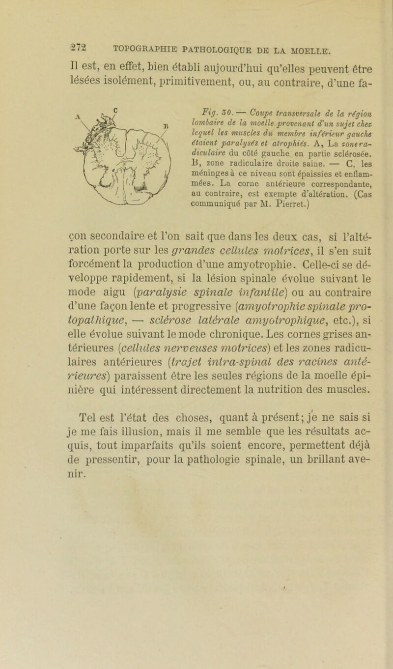 Il est, en effet, bien établi aujourd’hui qu’elles peuvent être lésées isolément, primitivement, ou, au contraire, d’une fa- Fig. 50.— Coupe transversale de la région lombaire de la moelle provenant d'un sujet chez lequel les muscles du, membre inférieur gauche étaient paralysés et atrophiés. A, La zonera- diculaire du côté gauche en partie sclérosée. B, zone radiculaire droite saine. — C, les méninges à ce niveau sont épaissies et enflam- mées. La corne antérieure correspondante, au contraire, est exempte d’altération. (Cas communiqué par M. Pierret.) çon secondaire et l’on sait que dans les deux cas, si l’alté- ration porte sur les grandes cellules motrices, il s’en suit forcément la production d’une amyotrophie. Celle-ci se dé- veloppe rapidement, si la lésion spinale évolue suivant le mode aigu (paralysie spinale infantile) ou au contraire d’une façon lente et progressive (amyotrophie spinale pro- topathique, — sclérose latérale amyotrophique, etc.), si elle évolue suivant le mode chronique. Les cornes grises an- térieures [cellules nerveuses motrices) et les zones radicu- laires antérieures (trajet intra-spinal des racines anté- rieures) paraissent être les seules régions de la moelle épi- nière qui intéressent directement la nutrition des muscles. Tel est l’état des choses, quant à présent; je ne sais si je me fais illusion, mais il me semble que les résultats ac- quis, tout imparfaits qu’ils soient encore, permettent déjà de pressentir, pour la pathologie spinale, un brillant ave- nir.