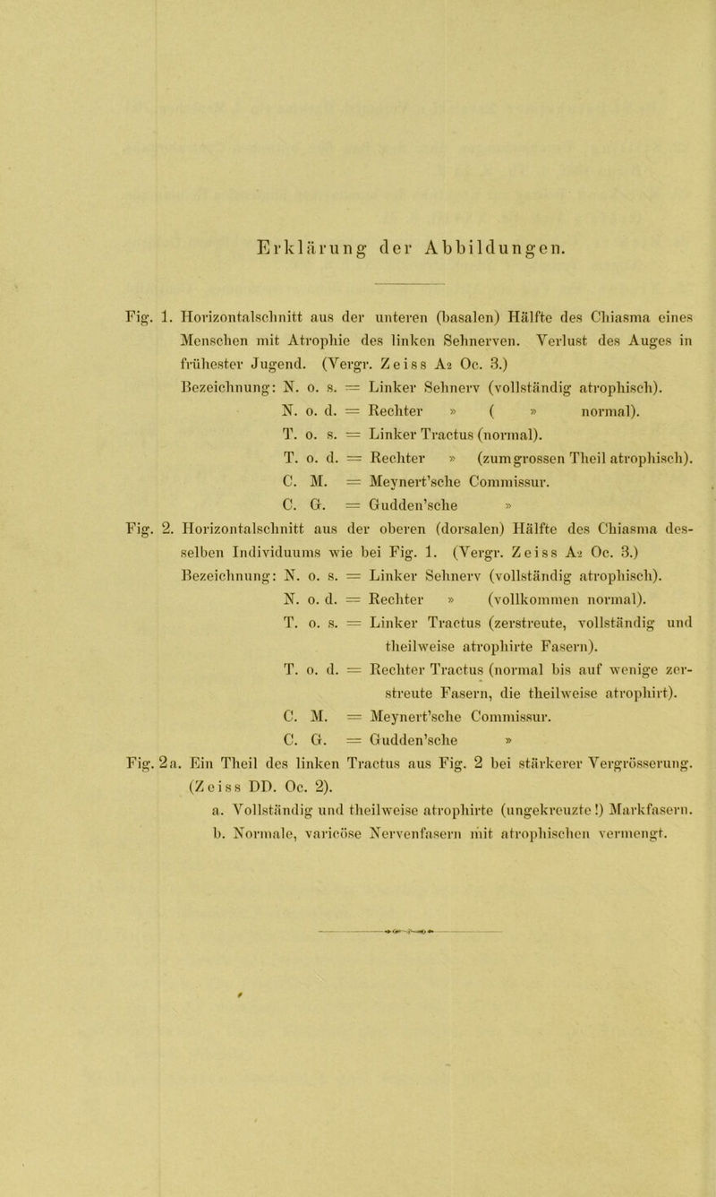 Erklärung der Abbildungen. Fig. 1. Horizontalschnitt aus der unteren (basalen) Hälfte des Cliiasma eines Menschen mit Atrophie des linken Sehnerven. Verlust des Auges in frühester Jugend. (Vergr. Zeiss A2 Oc. 3.) Bezeichnung: N. 0. s. = Linker Sehnerv (vollständig atrophisch). N. 0. d. = Rechter » ( » normal). T. 0. s. = Linker Tractus (normal). T. o. d. = Rechter » (zum grossen Theil atrophisch). C. M. = Meynert’sche Commissur. C. G. = Gudden’sche » Fig. 2. Horizontalschnitt aus der oberen (dorsalen) Hälfte des Chiasma des- selben Individuums wie bei Fig. 1. (Vergr. Zeiss A> Oc. 3.) Bezeichnung: N. 0. s. = Linker Sehnerv (vollständig atrophisch). IST. 0. d. — Rechter » (vollkommen normal). T. o. s. = Linker Tractus (zerstreute, vollständig und theilweise atrophirte Fasern). T. 0. d. = Rechter Tractus (normal bis auf wenige zer- streute Fasern, die theilweise atrophirt). C. M. = Meynert’sche Commissur. C. G. = Gudden’sche » Fig. 2 a. Ein Theil des linken Tractus aus Fig. 2 bei stärkerer Vergrüsserung. (Zeiss DD. Oc. 2). a. Vollständig und theilweise atrophirte (ungekreuzte!) Markfasern. b. Normale, varicöse Nervenfasern mit atrophischen vermengt.