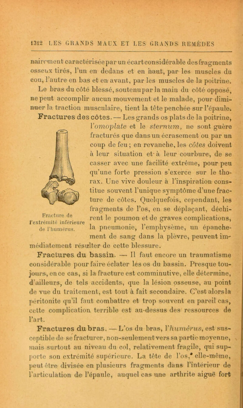 nairrment caractérisée par un écart considérable des fragments osseux tirés, l’un en dedans et en haut, par les muscles du cou, l’autre en bas et en avant, par les muscles de la poitrine. Le bras du côté blessé, soutenupar la main du côté opposé, ne peut accomplir aucun mouvement et le malade, pour dimi- nuer la traction musculaire, tient la tête penchée sur l’épaule. Fractures des côtes. — Les grands os plats de la poitrine, Yomoplate et le sternum, ne sont guère fracturés que dans un écrasement ou par un coup de feu; en revanche, les côtes doivent à leur situation et* à leur courbure, de se casser avec une facilité extrême, pour peu qu’une forte pression s’exerce sur le tho- rax. Une vive douleur à l’inspiration cons- titue souvent l’unique symptôme d’une frac- ture de côtes. Quelquefois, cependant, les fragments de l’os, en se déplaçant, déchi- . . „ . rent le poumon et de graves complications, 1 extrémité inférieure • i de l’humérus. pneumonie, 1 emphysème, un épanche- ment de sang dans la plèvre, peuvent im- médiatement résulter de cette blessure. Fractures du bassin. — 11 faut encore un traumatisme considérable pour faire éclater les os du bassin. Presque tou- jours, en ce cas, si la fracture est comminutive, elle détermine, d’ailleurs, de tels accidents, que la lésion osseuse, au point de vue du traitement, est tout à fait secondaire. C’est alorsla péritonite qu’il faut combattre et trop souvent en pareil cas, cette complication terrible est au-dessus des ressources de l’art. Fractures du bras. — L’os du bras, Vhumérus, est sus- ceptible de se fracturer, non-seulement vers sa partie moyenne, ^ mais surtout au niveau du col, relativement fragile, qui sup- porte son extrémité supérieure. La tête de l’os,* elle-même, peut être divisée en plusieurs fragments dans l’intérieur de l’articulation de l’épaule, auquel cas une arthrite aiguë fort