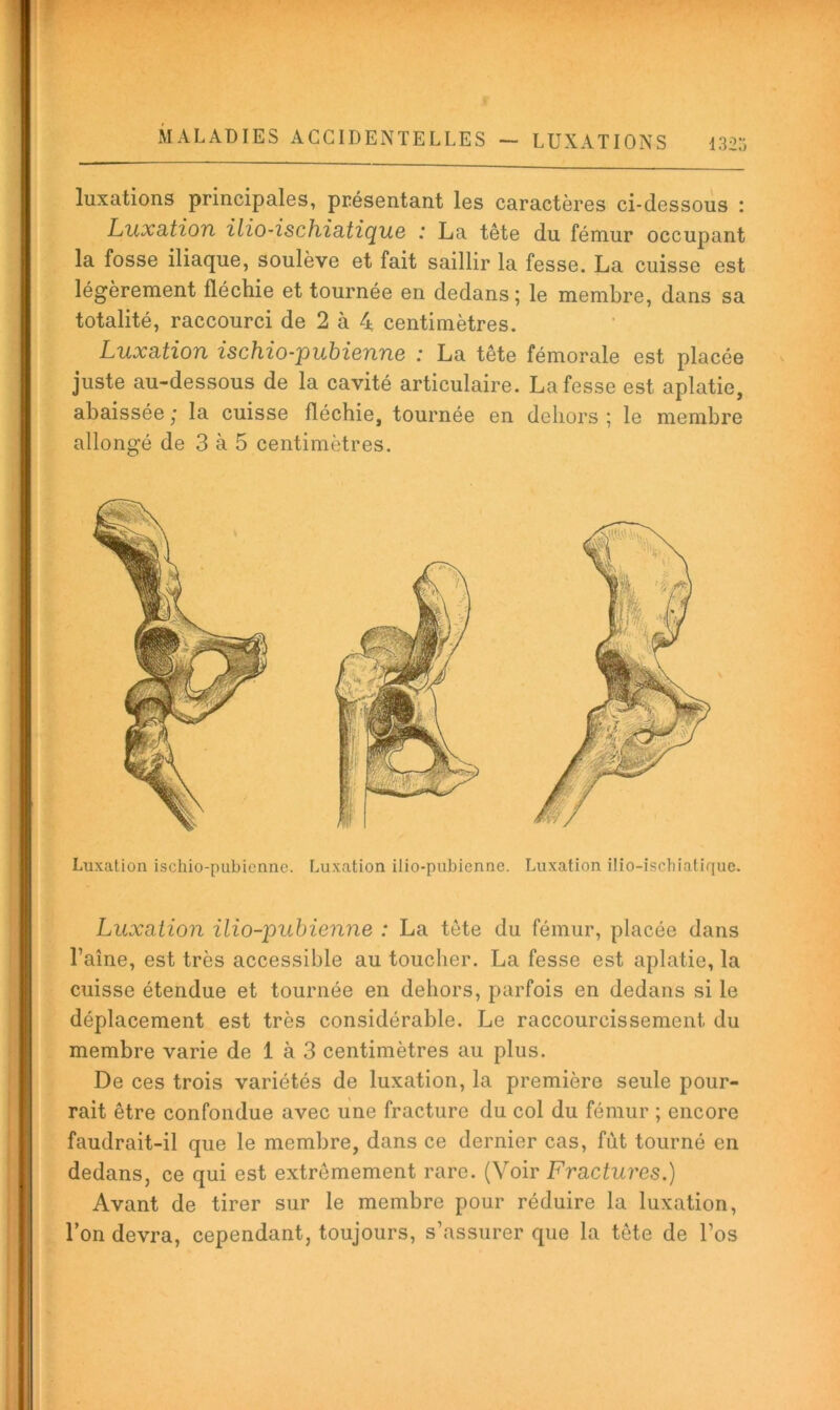 luxations principales, présentant les caractères ci-dessous : Luxâtioîi ilio-ischi3,tiç[ii6 : La tête du fémur occupant la fosse iliaque, soulève et fait saillir la fesse. La cuisse est ; légèrement fléchie et tournée en dedans; le membre, dans sa ; totalité, raccourci de 2 à 4 centimètres. Luxation ischio-pubienne : La tête fémorale est placée juste au-dessous de la cavité articulaire. La fesse est aplatie, ' abaissée ; la cuisse fléchie, tournée en dehors ; le membre . allongé de 3 à 5 centimètres. s Luxation ischio-pubienne. Luxation ilio-pubienne. Luxation ilio-ischiatique. l' ? Luxation ilio-pubienne : La tête du fémur, placée dans : Taine, est très accessible au toucher. La fesse est aplatie, la ÿ cuisse étendue et tournée en dehors, parfois en dedans si le ( déplacement est très considérable. Le raccourcissement du \ membre varie de 1 à 3 centimètres au plus. De ces trois variétés de luxation, la première seule pour- r rait être confondue avec une fracture du col du fémur ; encore ^ faudrait-il que le membre, dans ce dernier cas, fut tourné en > dedans, ce qui est extrêmement rare. (Voir Fraciiii’es.) Avant de tirer sur le membre pour réduire la luxation. Ton devra, cependant, toujours, s’assurer que la tête de Tos