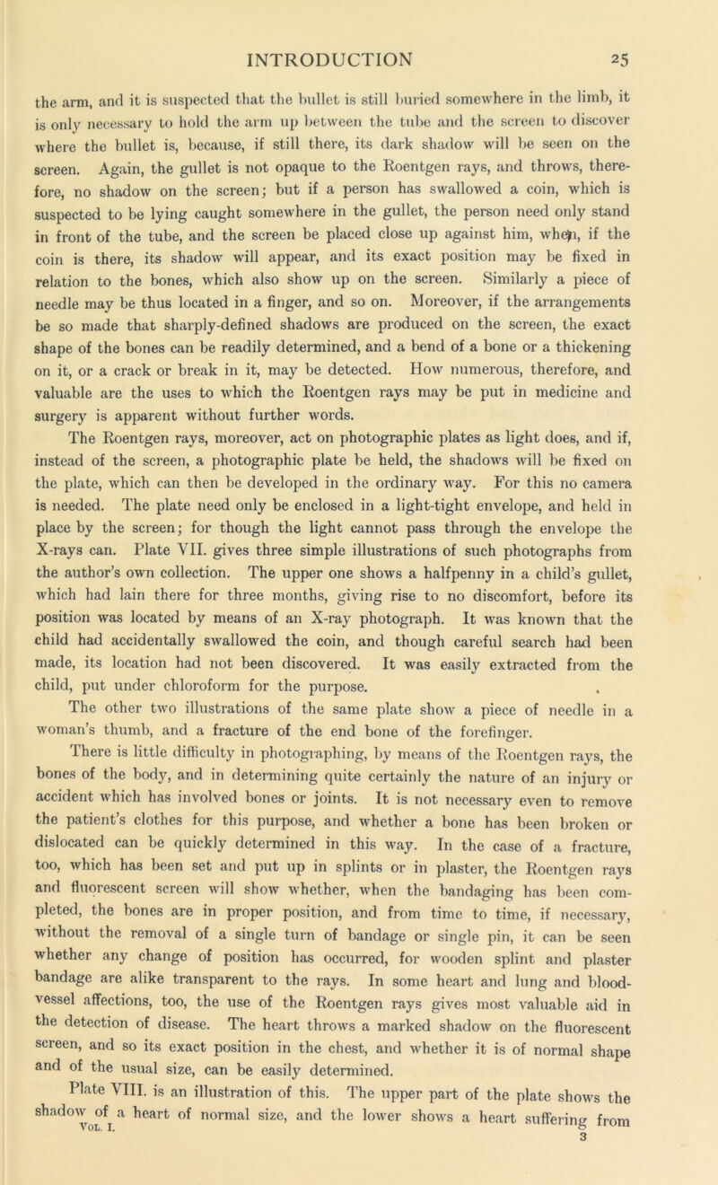 the arm, and it is suspected that the bullet is still buried somewhere in the limb, it is only necessary to hold the arm up between the tube and the screen to discover where the bullet is, because, if still there, its dark shadow will be seen on the screen. Again, the gullet is not opaque to the Roentgen rays, and throws, there- fore, no shadow on the screen; but if a person has swallowed a coin, which is suspected to be lying caught somewhere in the gullet, the person need only stand in front of the tube, and the screen be placed close up against him, whe>i, if the coin is there, its shadow will appear, and its exact position may be fixed in relation to the bones, which also show up on the screen. Similarly a piece of needle may be thus located in a finger, and so on. Moreover, if the arrangements be so made that sharply-defined shadows are produced on the screen, the exact shape of the bones can be readily determined, and a bend of a bone or a thickening on it, or a crack or break in it, may be detected. How numerous, therefore, and valuable are the uses to which the Roentgen rays may be put in medicine and surgery is apparent without further words. The Roentgen rays, moreover, act on photographic plates as light does, and if, instead of the screen, a photographic plate be held, the shadows will be fixed on the plate, which can then be developed in the ordinary way. For this no camera is needed. The plate need only be enclosed in a light-tight envelope, and held in place by the screen; for though the light cannot pass through the envelope the X-rays can. Plate VII. gives three simple illustrations of such photographs from the author’s own collection. The upper one shows a halfpenny in a child’s gullet, which had lain there for three months, giving rise to no discomfort, before its position was located by means of an X-ray photograph. It was known that the child had accidentally swallowed the coin, and though careful search had been made, its location had not been discovered. It was easily extracted from the child, put under chloroform for the purpose. The other two illustrations of the same plate show a piece of needle in a woman’s thumb, and a fracture of the end bone of the forefinger. There is little difficulty in photographing, by means of the Roentgen rays, the bones of the body, and in determining quite certainly the nature of an injury or accident which has involved bones or joints. It is not necessary even to remove the patient’s clothes for this purpose, and whether a bone has been broken or dislocated can be quickly determined in this way. In the case of a fracture, too, which has been set and put up in splints or in plaster, the Roentgen rays and fluorescent screen will show whether, when the bandaging has been com- pleted, the bones are in proper position, and from time to time, if necessary, without the removal of a single turn of bandage or single pin, it can be seen whether any change of position has occurred, for wooden splint and plaster bandage are alike transparent to the rays. In some heart and lung and blood- vessel affections, too, the use of the Roentgen rays gives most valuable aid in the detection of disease. The heart throws a marked shadow on the fluorescent screen, and so its exact position in the chest, and whether it is of normal shape and of the usual size, can be easily determined. Plate VIII. is an illustration of this. The upper part of the plate shows the shadow of a heart of normal size, and the lower shows a heart suffering from 3