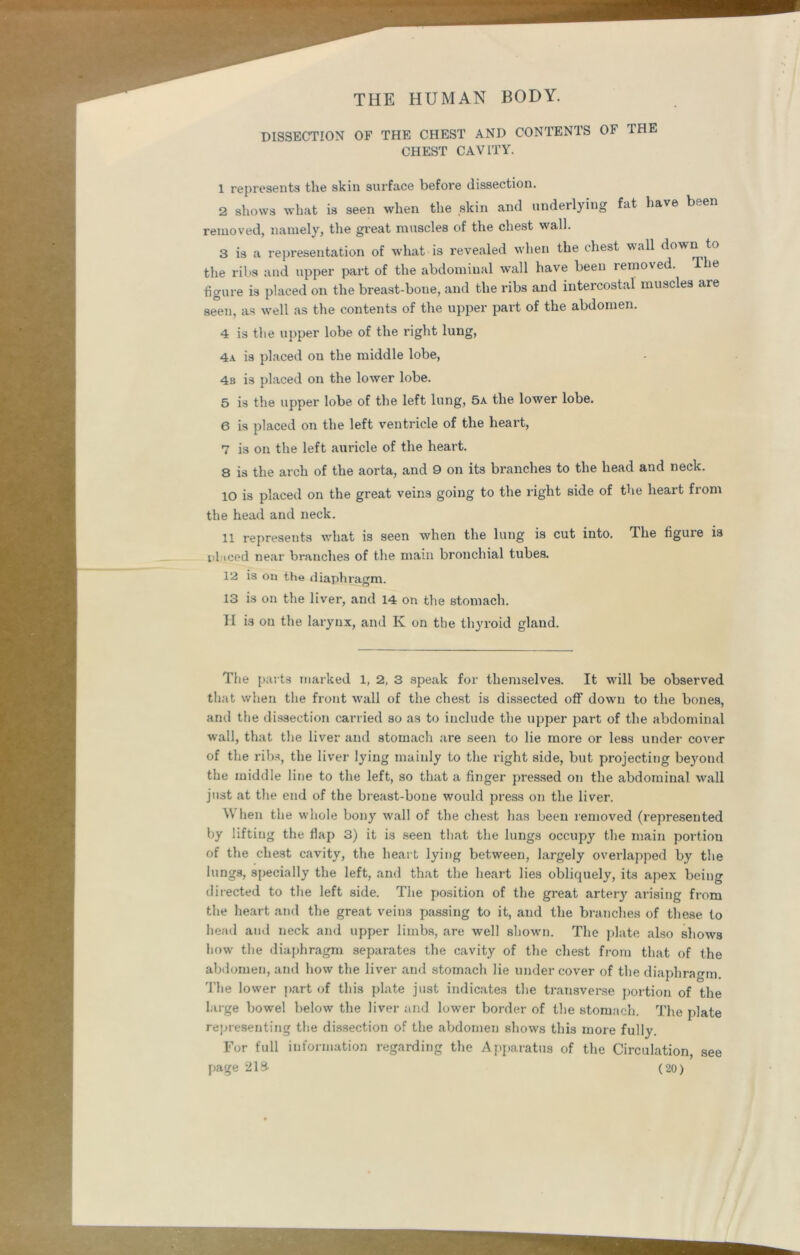 DISSECTION OF THE CHEST AND CONTENTS OF 1HE CHEST CAVITY. 1 represents tlie skin surface before dissection. 2 shows what is seen when the skin and underlying fat have been removed, namely, the great muscles of the chest wall. 3 is a representation of what is revealed when the chest v\all down the ribs and upper part of the abdominal wall have been removed. The figure is placed on the breast-bone, and the ribs and intercostal muscles are seen, as well as the contents of the upper part of the abdomen. 4 is the upper lobe of the right lung, 4a is placed ou the middle lobe, 4b is placed on the lower lobe. 5 is the upper lobe of the left lung, 5a the lower lobe. 6 is placed on the left ventricle of the heart, 7 is on the left auricle of the heart. 8 is the arch of the aorta, and 9 on its branches to the head and neck. 10 is placed on the great veins going to the right side of the heart from the head and neck. 11 represents what is seen when the lung is cut into. The figure is placed near branches of the main bronchial tubes. 12 is on the diaphragm. 13 is on the liver, and 14 on the stomach. H is on the larynx, and Iv on the thyroid gland. The parts marked 1, 2, 3 speak for themselves. It will be observed that when the front wall of the chest is dissected off down to the bones, and the dissection carried so as to include the upper part of the abdominal wall, that the liver and stomach are seen to lie more or less under cover of the ribs, the liver lying mainly to the right side, but projecting beyond the middle line to the left, so that a finger pressed on the abdominal wall just at the end of the breast-bone would press on the liver. When the whole bony wall of the chest has been removed (represented by lifting the fiap 3) it is seen that the lungs occupy the main portion of the chest cavity, the heart lying between, largely overlapped by the lungs, specially the left, and that the heart lies obliquely, its apex being directed to the left side. The position of the great artery arising from the heart and the great veins passing to it, and the branches of these to head and neck and upper limbs, are well shown. The plate also shows how the diaphragm separates the cavity of the chest from that of the abdomen, and how the liver and stomach lie undercover of the diaphragm. The lower part of this plate just indicates the ti'ansverse portion of the large bowel below the liver and lower border of the stomach. The plate representing the dissection of the abdomen shows this more fully. For full information regarding the Apparatus of the Circulation, page 218- (20) see