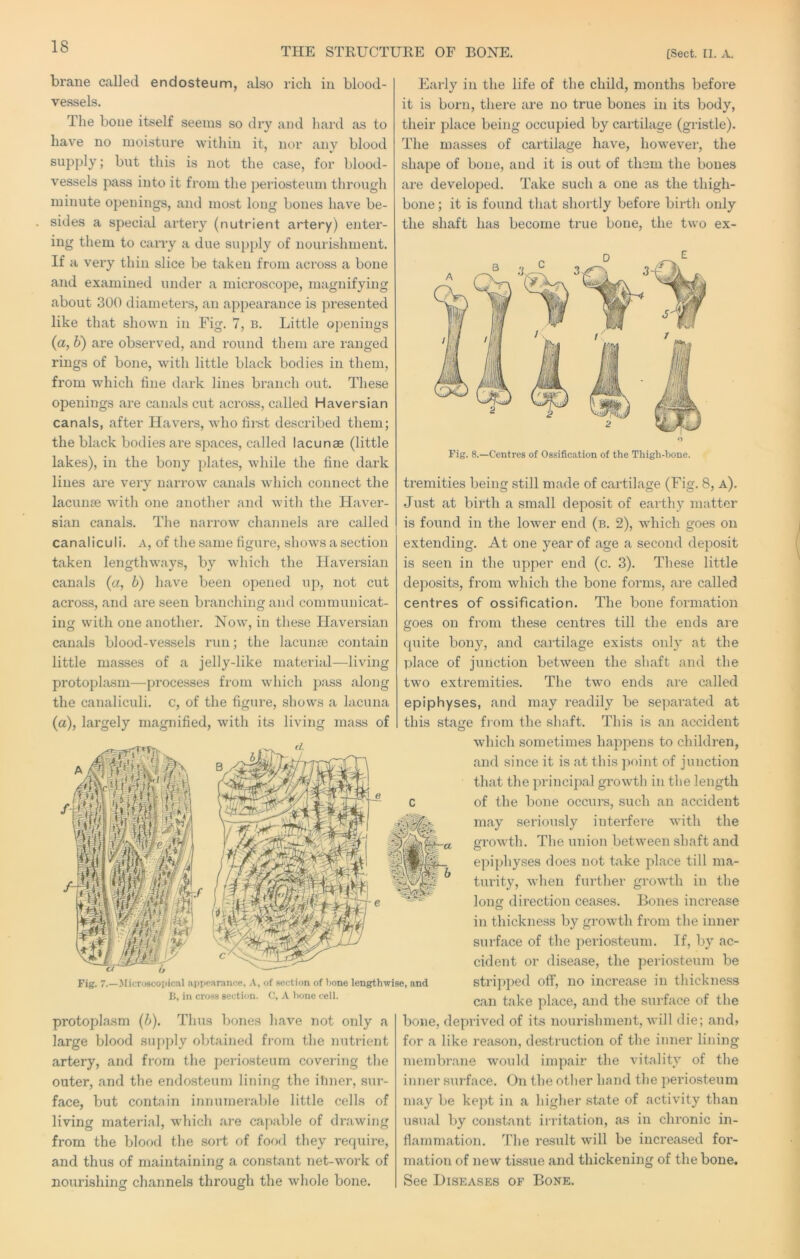 THE STRUCTUKE OF BONE. [Sect. II. A. brane called endosteum, also rich iu blood- vessels. The bone itself seems so dry and hard as to have no moisture witliin it, nor any blood supply; but this is not the case, for blood- vessels pass into it from the periosteum through minute openings, and most long bones have be- sides a special artery (nutrient artery) enter- ing them to carry a due sui)ply of nourishment. If a very thin slice be taken from across a bone and examined under a microscope, magnifying about 300 diameters, an appearance is presented like that shown in Fig. 7, b. Little openings (a, b) are observed, and round them are ranged rings of bone, with little black bodies in them, from which fine dark lines branch out. These openings are canals cut across, called Haversian canals, after Havers, whofii-st described them; the black bodies are spaces, called lacunae (little lakes), in the bony plates, while the fine dark lines are very narrow canals which connect the lacunae with one another and with the Haver- sian canals. The narrow channels are called canaliculi. A, of the same figure, shows a section taken lengthways, by which the Haversian canals (a, b) have been opened up, not cut across, and are seen branching and communicat- ing with one another. Now, in these Haversian canals blood-vessels run; the lacunae contain little masses of a jelly-like mateidal—living protoplasm—processes from which pass along the canaliculi. c, of the figure, shows a lacuna (a), largely magnified, with its living mass of Early in the life of the child, months before it is born, there are no true bones in its body, their place being occupied by cartilage (gristle). The masses of cartilage have, however, the shape of bone, and it is out of them the bones are developed. Take such a one as the thigh- bone ; it is found that shortly before birth only the shaft has become true bone, the two ex- c? h Fig. 7.—Micro8copic.il appearance. A, of section of bone lengthwise, and 15, in cross section. C, A bone cell. protoplasm [h). Thus bones have not only a large blood supply obtained from the nutrient artery, and from the periosteum covering the outer, and the endosteum lining the iliner, sur- face, but contain innumerable little cells of living material, which are capable of drawing from the blood the sort of fof)d they require, and thus of maintaining a constant net-work of nourishing channels through the whole bone. tremities being still made of cartilage (Fig. 8, a). Just at birth a small deposit of earthy matter is found in the lower end (b. 2), which goes on extending. At one year of age a second deposit is seen in the upper end (c. 3). These little deposits, from which the bone forms, are called centres of ossification. The bone formation goes on from these centres till the ends are quite bony, and cartilage exists only at the place of junction between the shaft and the two extremities. The two ends are called epiphyses, and may readily be se])arated at this staire from the shaft. This is an accident which sometimes happens to children, and since it is at this point of junction that the jirincipal growth in the length of the bone occurs, such an accident may seriously interfere with the growth. The union between shaft and epiphyses does not take place till ma- turity, when further growth in the long direction ceases. Bones increase in thickness by growth from the inner surface of the periosteum. If, by ac- cident or disease, the periosteum be stripped off, no increase in thickness can take place, and the surface of the bone, deprived of its nourishment, will die; and> for a like reason, destruction of the inner lining membrane would impair the vitality of the inner surface. On the other hand the pei’iosteum may be kept in a higher state of activity than usual l)y constant irritation, as in chronic in- flammation. The result will be increased for- mation of new tissue and thickening of the bone. See Diseases of Bone.