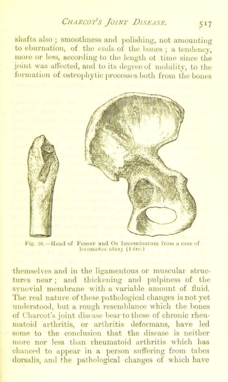 shafts also ; smoothness and polishing, not amounting to eburnation, of the ends of the bones ; a tendency, more or less, according to the length ot time since the joint was affected, and to its degree of mobility, to the formation of osteophytic processes both from the bones Fig. M. —Head of Femur and Os luuoiniuatum from a case of locomotoj atnx} (f£ro.) themselves and in the ligamentous or muscular struc- tures near; and thickening and pulpiness of the synovial membrane with a variable amount of fluid. The real nature of these pathological changes is not yet understood, but a rough resemblance which the bones of Charcot’s joint disease bear to those of chronic rheu- matoid arthritis, or arthritis deformans, have led some to the conclusion that the disease is neither more nor less than rheumatoid arthritis which has chanced to appear in a person suffering from tabes dorsalis, and the pathological changes of which have