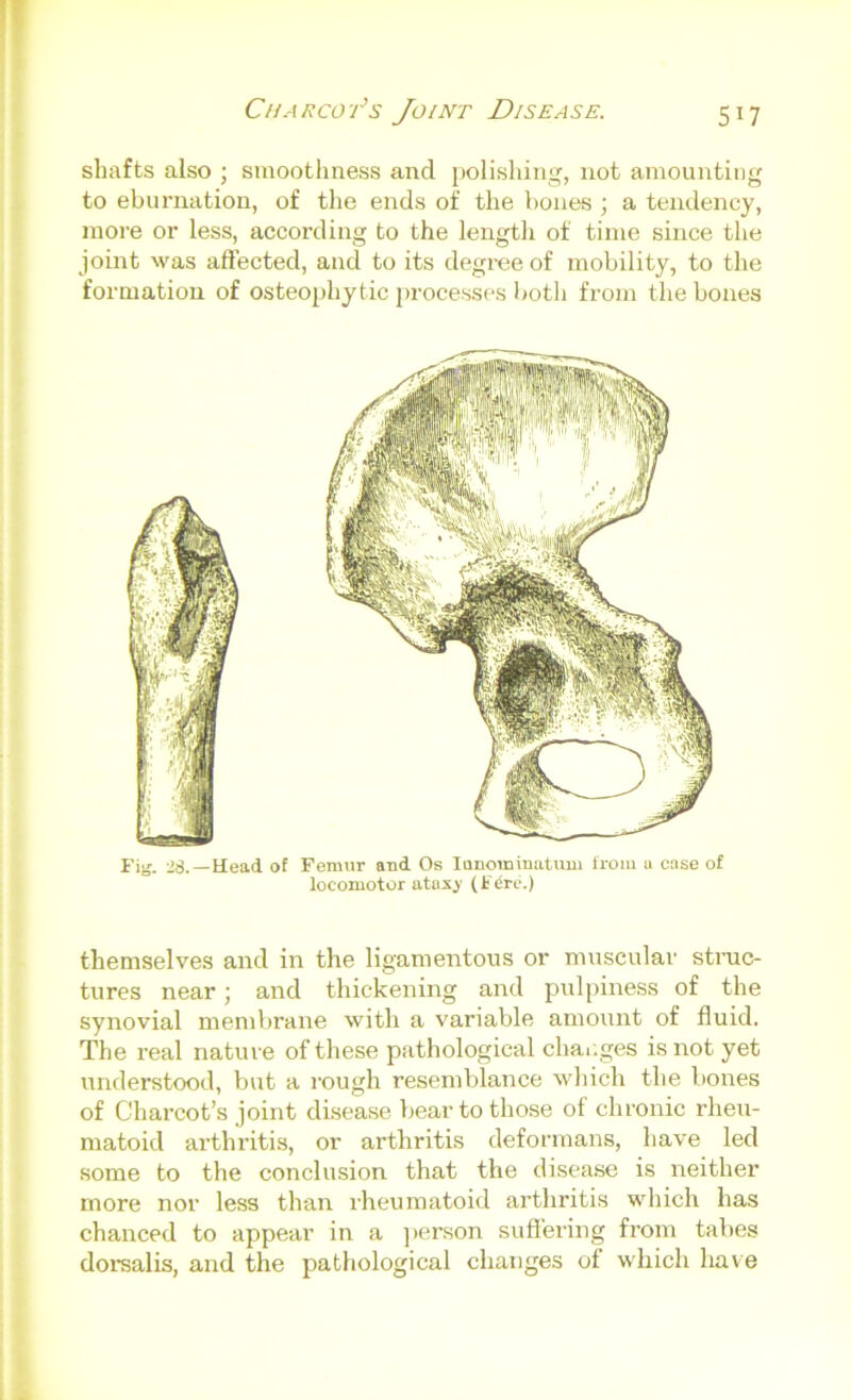 shafts also ; smoothness and polisliing, not amounting to eburnation, of the ends of the bones ; a tendency, more or less, according to the length of time since the joint was affected, and to its degree of mobility, to the formation of osteo2>hytic processes I)otli from the bones Fig. :i8.—Head of Femur and Os lunominatimi Irom u case of locomotor ataxj’ (F^rtS) themselves and in the ligamentous or muscular stnic- tures near; and thickening and pnljiiness of the synovial membrane with a variable amount of fluid. The real nature of these pathological changes is not yet understood, but a rough resemblance which the bones of Charcot’s joint disease bear to those of chronic rheu- matoid arthritis, or arthritis deformans, have led some to the conclu.sion that the disease is neither more nor less than rheumatoid arthritis which has chanced to appear in a ]>erson suffering from tabes dorsalis, and the pathological changes of which have