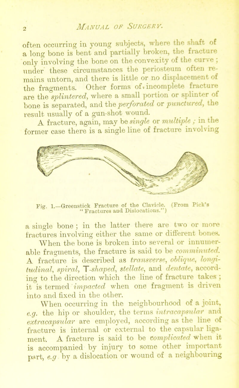 often occurring in young subjects, where the shaft of a long bone is bent and partially broken, the fracture only involving the bone on the convexity of the cur\e , under these circumstances the periosteum often re- mains untorn, and there is little or no displacement of the fragments. Other forms of. incomplete fracture are the splintered, where a small portion or splinter of bone is separated, and the perforated or punctured, the result usually of a gun-shot wound. A fracture, again, may be single or multiple ; in the former case there is a single line of fracture involving Fig. 1.—Greenstiok Fracture of the Clavicle. (From Pick’s “ Fractures aud Dislocations.”) a single bone ; in the latter there are two or more fractures involving either the same or different bones. When the bone is broken into several or innumer- able fragments, the fracture is said to be comminuted. A fracture is described as transverse, oblique, longi- tudinal, spiral, T-shaped, stellate, and dentate, accord- ing to the direction which the line of fracture takes ; it is termed impacted when one fragment is driven into and fixed in the other. When occurring in the neighbourhood of a joint, e.g. the hip or shoulder, the terms inlracapsular and extracapsular are employed, according as the line of fracture is internal or external to the capsular liga- ment. A fracture is said to be complicated when it is accompanied by injury to some other important pai-t, e.g by a dislocation or wound of a neighbouring