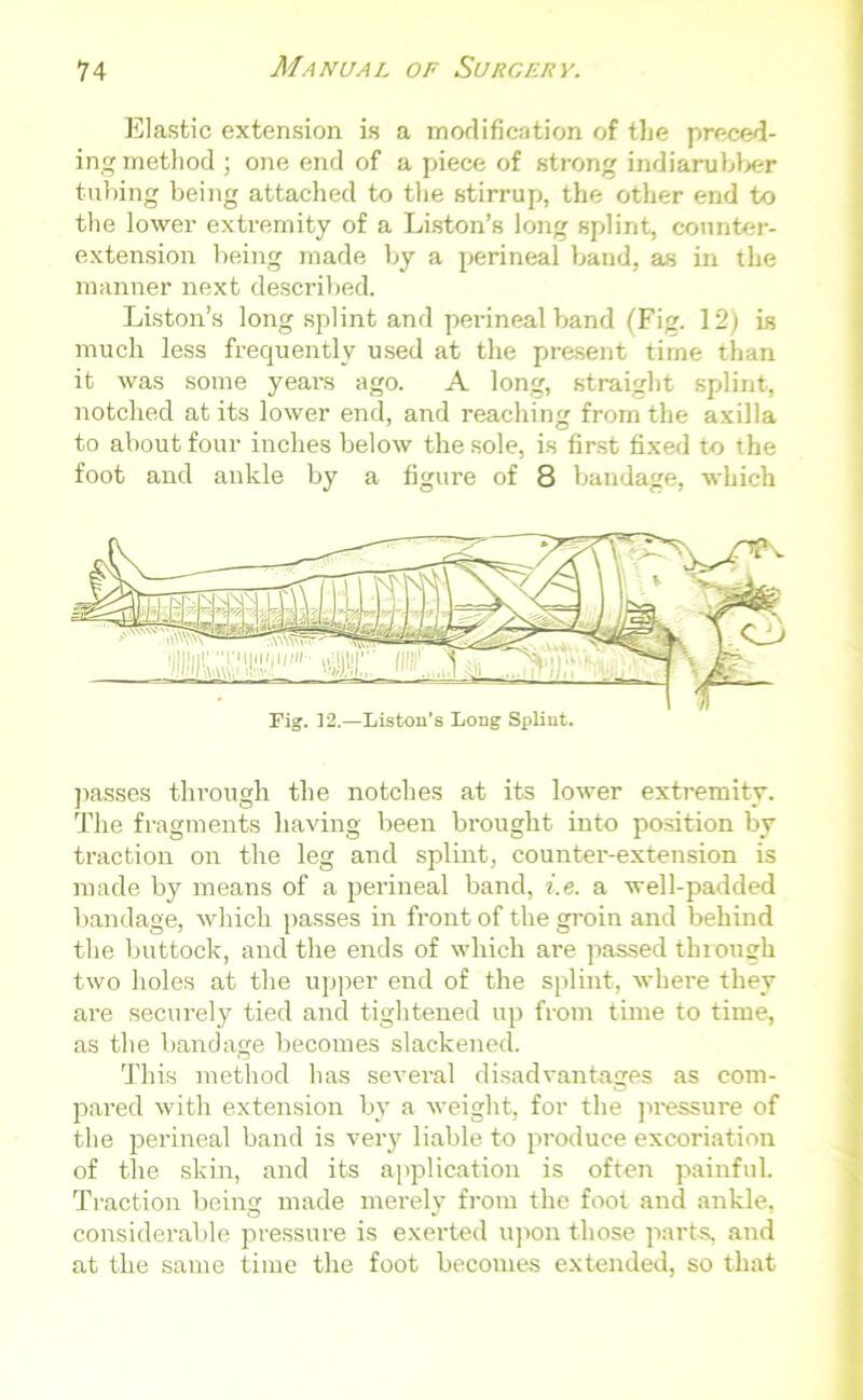 Elastic extension is a modification of the preced- ing method ; one end of a piece of strong indiarubber tubing being attached to the stirrup, the other end to the lower extremity of a Liston’s long splint, counter- extension being made by a perineal band, as in the manner next described. Liston’s long splint and perineal band (Fig. 12) is much less frequently used at the present time than it was some years ago. A long, straight splint, notched at its lower end, and reaching from the axilla to about four inches below the sole, is first fixed to the foot and ankle by a figure of 8 bandage, which Fig. 12.—Liston's Long Splint. passes through the notches at its lower extremity. The fragments having been brought into position by traction on the leg and splint, counter-extension is made by means of a perineal band, i.e. a well-padded bandage, which passes in front of the groin and behind the buttock, and the ends of which are passed through two holes at the upper end of the splint, where they are securely tied and tightened up from time to time, as the bandage becomes slackened. This method has several disadvantages as com- pared with extension by a weight, for the pressure of the perineal band is very liable to produce excoriation of the skin, and its application is often painful. Traction being made merely from the foot and ankle, considerable pressure is exerted upon those parts, and at the same time the foot becomes extended, so that