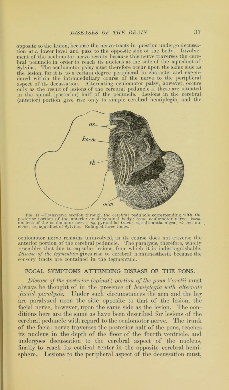 opposite to the lesiou, because the nerve-tracts in question undergo decussa- tion at a lower level and pass to the opposite side of the body. Involve- ment of the oculomotor nerve results because this nerve traverses the cere- bral peduncle in order to reach its nucleus at the side of the aqueduct of ' Sylvius. The oculomotor palsy must therefore occur upon the same side as the lesion, for it is to a certain degree peripheral in character and engen- dered within the intramedullary course of the nerve to the peripheral aspect of its decussation. Alternating oculomotor palsy, however, occurs only as the result of lesions of the cerebral peduncle if these are situated in the spinal (posterior) half of the peduncle. Lesions in the cerebral (anterior) portion give rise only to simple cerebral hemiplegia, and the Km. 11.—Transverse section through the cerebral peduncle corresponding with the posterior portion of the anterior quadrigeminal body: occm, oculomotor nerve: kocm. nucleus of the oculomotor nerve; vy, pyramidal tract: m, substantia nigra; rk, red nu- cleus; as, aqueduct of Sylvius. Enlarged-three times. oculomotor nerve remains uninvolved, as its course does not traverse the anterior portion of the cerebral peduncle. The paralysis, therefore, wholly resembles that due to capsular lesions, from which it is indistinguishable. Disease of the tegmentum gives rise to cerebral hemianesthesia because the sensory tracts are contained in the tegmentum. FOCAL SYMPTOMS ATTENDING DISEASE OF THE PONS. Disease of the posterior (spinal) portion of the pons Yarolii must always be thought of in the presence of hemiplegia v'ith alternate, facial paralysis. Under such circumstances the arm and the leg are paralyzed upon the side opposite to that of the lesion, the facial nerve, however, upon the same side as the lesion. The con- ditions here are the same as have been described for lesions of the cerebral peduncle with regard to the oculomotor nerve. The trunk of the facial nerve traverses the posterior half of the pons, reaches its nucleus in the depth of the floor of the fourth ventricle, and undergoes decussation to the cerebral aspect of the nucleus, finally to reach its cortical Center in the opposite cerebral hemi- sphere. Lesions to the peripheral aspect of the decussation must,