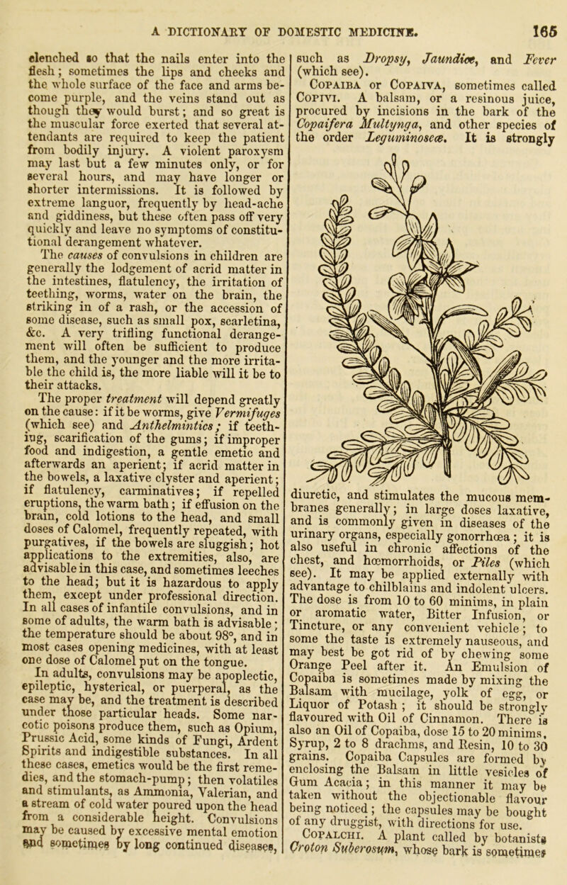 flenched io that the nails enter into the flesh; sometimes the lips and cheeks anc the whole surface of the face and arms be- come purple, and the veins stand out as though they would burst; and so great is the muscular force exerted that several at- tendants are required to keep the patient from bodily injury. A violent paroxysm may last but a few minutes only, or for several hours, and may have longer or shorter intermissions. It is followed by extreme languor, frequently by head-ache and giddiness, but these often pass otf very quickly and leave no symptoms of constitu- tional derangement whatever. The causes of convulsions in children are generally the lodgement of acrid matter in the intestines, flatulency, the irritation of teething, worms, water on the brain, the striking in of a rash, or the accession of some disease, such as small pox, scarletina, &c. A very trifling functional derange- ment will often be sufficient to produce them, and the younger and the more irrita- ble the child is, the more liable will it be to their attacks. The ^YO^Qx treatment will depend greatly on the cause: if it be worms, give Vermifuges (which see) and Anthelmintics; if teeth- ing, scarification of the gums; if improper food and indigestion, a gentle emetic and afterwards an aperient; if acrid matter in the bowels, a laxative clyster and aperient; if flatulency, caiminatives; if repelled eruptions, the warm bath; if effusion on the brain, cold lotions to the head, and small doses of Calomel, frequently repeated, with purgatives, if the bowels are sluggish; hot applications to the extremities, also, are advisable in this case, and sometimes leeches to the head; but it is hazardous to apply them, except under professional direction. In all cases of infantile convulsions, and in some of adults, the warm bath is advisable; the temperature should be about 98®, and in most cases opening medicines, with at least one dose of Calomel put on the tongue. In adults, convulsions may be apoplectic, epileptic, hysterical, or puerperal, as the case may be, and the treatment is described under those particular heads. Some nar- cotic poisons produce them, such as Opium, Prussic Acid, some kinds of Fungi, Ardent Spirits and indigestible substances. In all these cases, emetics would be the first reme- dies, and the stomach-pump; then volatiles and stimulants, as Ammonia, Valerian, and a stream of cold water poured upon the head from a considerable height. Convulsions may be caused by excessiye mental emotion ftnq sometimes oy long continued (fiseases, such as Dropsy^ Jaundice^ and Fever (which see). Copaiba or Copaiva, sometimes called Copivi. A balsam, or a resinous juice, procured by incisions in the bark of the Copaifera Multynga^ and other species of the order Leguminosece, It is strongly diuretic, and stimulates the mucous mem- branes generally; in large doses laxative, and is commonly given in diseases of the urinary organs, especially gonorrhoea; it is also useful in chronic affections of the chest, and hoemorrhoids, or Piles (which see). It may be applied externally ^vith advantage to chilblains and indolent ulcers. The dose is from 10 to 60 minims, in plain or aromatic water. Bitter Infusion, or Tincture, or any convenient vehicle; to some the taste is extremely nauseous, and may best be got rid of by chewing some Orange Peel after it. An Emulsion of Copaiba is sometimes made by mixing the Balsam with mucilage, yolk of egg, or Liquor of Potash ; it should be strongly flavoured ivith Oil of Cinnamon. There is also an Oil of Copaiba, dose 15 to 20 minima. Syrup, 2 to 8 drachms, and Besin, 10 to 30 grains. Copaiba Capsules are formed by mclosing the Balsam in little vesicles of jum Acacia; in this manner it may be ■;aken without the objectionable flavour leing noticed ; the capsules may be bought druggist, with directions for use. CopALCHi. A plant called by botanists yroton ouoerosum^ whose bark is sonaetime#