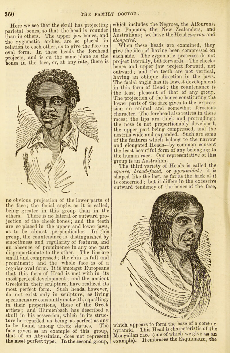 Here we see that the skull has projecting parietal bones, go that the head is rounder than in others. The upper jawbones, and the zygomatic arches, are so placed in relation to each other, as to give the face an oval form. In these heads the forehead projects, and is on the same plane as the bones in the face, or, at any rate, there is no obvious prujediun of the lower parts of the face; the facial angle, as it is called, being greater in this group than in the others. There is no lateral or outward pro- jection of the cheek bones; and the teeth are so placed in the upper and lower jaws, as to be almost perpendicular. In this group, the countenance is distinguished by smoothness and regularity of features, and nn absence of prominence in any one part disproportionate to the other. Tne lips are small and compressed ; the chin is full and fi'ominent; and the whole face is of a regular oval form. It is amongst Europeans that this fonn of Head is met with in its most perfect development; and the ancient Greeks in their sculpture, have realized its most perfect form. Such heads, however, do not exist only in sculpture, as living specimens are constantly met with, equalling, in their proportions, those of the Greek artists; and Blumenbach has described a skull in his possession, which in its struc- ture he regarded as being as perfect as any to be found among Greek statues. The face given as an example of this group, that of an Abyssinian, does not represent the most perfect type. In the second group, which includes the Negroes, the Alfourou.®, the Papuans, the New Zealanders, and Australians; we have the Head narrow and elongated. AVhen these heads are examined, they give the idea of having been compressed on each side. The zygomatic processes do not project laterally, but forwards. The cheek- bones and upper jaw project forward, not outward; and the teeth are not vertical, having an oblique direction in the jaws. The facial angle has its lowest development in this form of Head; the countenance is the least pleasant of that of any group. The projection of the bones constituting the lower parts of the face gives to the expres- sion an animal and somewhat ferocious cliaracter. The forehead also reiires in these races; the lips are thick and protruding; the nose is not proportionably developed, the upper part being compressed, and the nostrils wide and expanded. Such are some of the features which belong to the narrow and elongated Heads—by common consent the least beautiful form of any belonging to the human race. Our representative of this group is an Australian. The third variety of Heads is called^ the square^ broad-faced., or pyramidal; it is shaped like the last, as far as the back of it is concerned ; but it differs in the excessive outward tendency of the bones of the face, which appears to form the base of a cone ( r pyramid. This Head is characteristic of the Mongolian race (one of which we give as an example). It embraces the Esquimaux, tho