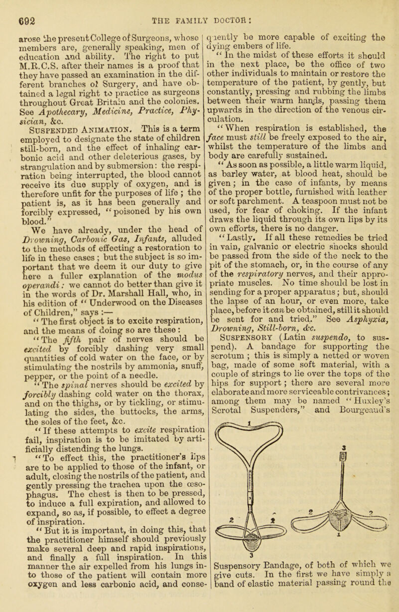 arose the present College of Surgeons, whose members are, generally speaking, men of education and ability. The right to put M.R.C.S. after their names is a proof that they have passed an examination in the dif- ferent branches ol Surgery, and have ob- tained a legal right to practice as surgeons throughout Great Britain and the colonies. See Apothecary, Medicine, Practice, Phy- sician, &c. Suspended Animation. This is a term employed to designate the state of children still-boni, and the effect of inhaling car- bonic acid and other deleterious gases, by strangulation and by submersion: the respi- ration being interrupted, the blood cannot receive its due supply of oxygen, and is therefore unfit for the purposes of life ; the patient is, as it has been generally and forcibly expressed, ‘‘ poisoned by his own blood.” We have already, under the head of Prawning, Carbonic Gas, Infants, alluded to the methods of effecting a restoration to life in these cases ; but the subject is so im- portant that we deem it our duty to give here a fuller explanation of the modus operandi: we cannot do better than give it in the words of Dr. Marshall Hall, who, in his edition of “ Underwood on the Diseases of Children,” says :— “ The first object is to excite respiration, and the means of doing so are these : “The fifth pair of nerves should be excited by forcibly dashing very small quantities of cold water on the face, or by stimulating the nostrils by ammonia, snuff, pepper, or the point of a needle. “ The spinal nerves should be excited by forcibly dashing cold water on the thorax, and on the thighs, or by tickling, or stimu- lating the sides, the buttocks, the arms, the soles of the feet, &c. “ If these attempts to excite respiration fail, inspiration is to be imitated by arti- ficially distending the lungs. “To effect this, the practitioners lips are to be applied to those of the infant, or adult, closing the nostrils of the patient, and gently pressing the trachea upon the oeso- phagus. The chest is then to be pressed, to induce a full expiration, and allowed to expand, so as, if possible, to effect a degree of inspiration. “ But it is important, in doing this, that the practitioner himself should previously make several deep and rapid inspii’ations, and finally a full inspiration. In this manner the air expelled from his lungs in- to those of the patient will contain more oxygen and less carbonic acid, and conse- quently be more capable of exciting the dying embers of life. “ In the midst of these efforts it should in the next place, be the office of two other individuals to maintain or restore the temperature of the patient, by gently, but constantly, pressing and rubbing the limbs between their warm han;ls, passing them upwards in the direction of the venous cir- culation. “When respiration is established, the face must still be freely exposed to the air, whilst the temperature of the limbs and body are carefully sustained. “ As soon as possible, a little warm liquid, as barley water, at blood heat, should be given; in the case of infants, by means of the proper bottle, furnished with leather or soft parchment. A teaspoon must not be used, for fear of choking. If the infant draws the liquid through its own lips by its own efforts, there is no danger. “Lastly. If all these remedies be tried in vain, galvanic or electric shocks should be passed from the side of the neck to the pit of the stomach, or, in the course of any of the respiratory nerves, and their appro- priate muscles. No time should be lost in sending for a proper apparatus; but, should the lapse of an hour, or even more, take place, before it can be obtained, still it should be sent for and tried,” See Asphyxia, Prawning, Still-born, <Scc. Suspensory (Latin suspendo, to sus- pend). A bandage for supporting the scrotum ; this is simply a netted or woven bag, made of some soft material, with a couple of strings to lie over the tops of the hips for support; there are several more elaborate and more serviceable contrivances; among them may be named “Huxley’s Scrotal Suspendei's,” and Bourgeaud’s Suspensory Bandage, of both of which we give cuts. In the first we have simply a band of elastic material passing round the