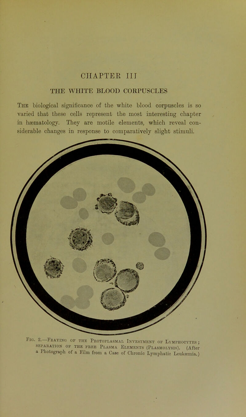 THE WHITE BLOOD CORPUSCLES The biological significance of the white blood corpuscles is so varied that these cells represent the most interesting cliapter in htematology. They are motile eleruents, which reveal con- siderable changes in response to comparatively slight Stimuli. Fio. 2.—Frating of THE Protoplasmas Investment of Lymphocytes ; SEPARATION OF THE FREE PLASMA ELEMENTS (PLASMOLYSIS). (After a Photogiapli of a Film frora a Case of Chronic Lymphatic Leukannia.)