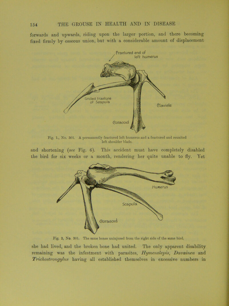 forwards and upwards, riding upon the larger portion, and there becoming fixed firmly by osseous union, but with a considerable amount of displacement Fractured end of / left humerus Fig. 1., No. 301. A permanently fractured left humerus and a fractured and reunited left shoulder blade. and shortening (see Fig. 6). This accident must have completely disabled the bird for six weeks or a month, rendering her quite unable to fly. Yet Fig. 2, No. 301. The same bones uninjured from the right side of the same bird. she had lived, and the broken bone had united. The only apparent disability remaining was the infestment with parasites, Hymenolejns, Davainect and Trichostrongylus having all established themselves in excessive numbers in