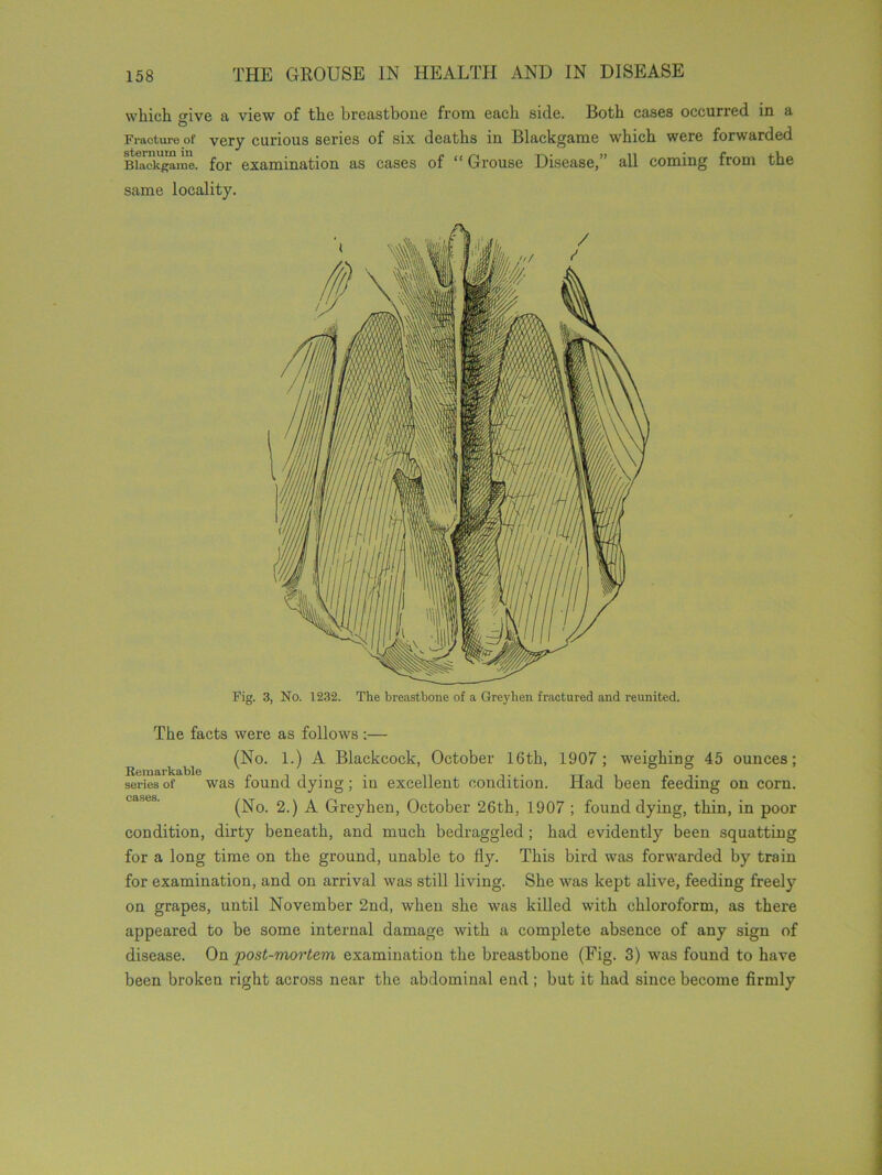 which give a view of the breastbone from each side. Both cases occurred in a Fraoture of very curious series of six deaths in Blackgame which were forwarded Biackgame. for examination as cases of “ Grouse Disease,” all coming from the same locality. Fig. 3, No. 1232. The breastbone of a Greyhen fractured and reunited. The facts were as follows :— (No. 1.) A Blackcock, October 16th, 1907; weighing 45 ounces; series of was found dying; in excellent condition. Had been feeding on corn. (No. 2.) A Greyhen, October 26th, 1907 ; found dying, thin, in poor condition, dirty beneath, and much bedraggled ; had evidently been squatting for a long time on the ground, unable to fly. This bird was forwarded by train for examination, and on arrival was still living. She was kept alive, feeding freely on grapes, until November 2nd, when she was killed with chloroform, as there appeared to be some internal damage with a complete absence of any sign of disease. On post-mortem examination the breastbone (Fig. 3) was found to have been broken right across near the abdominal end ; but it had since become firmly