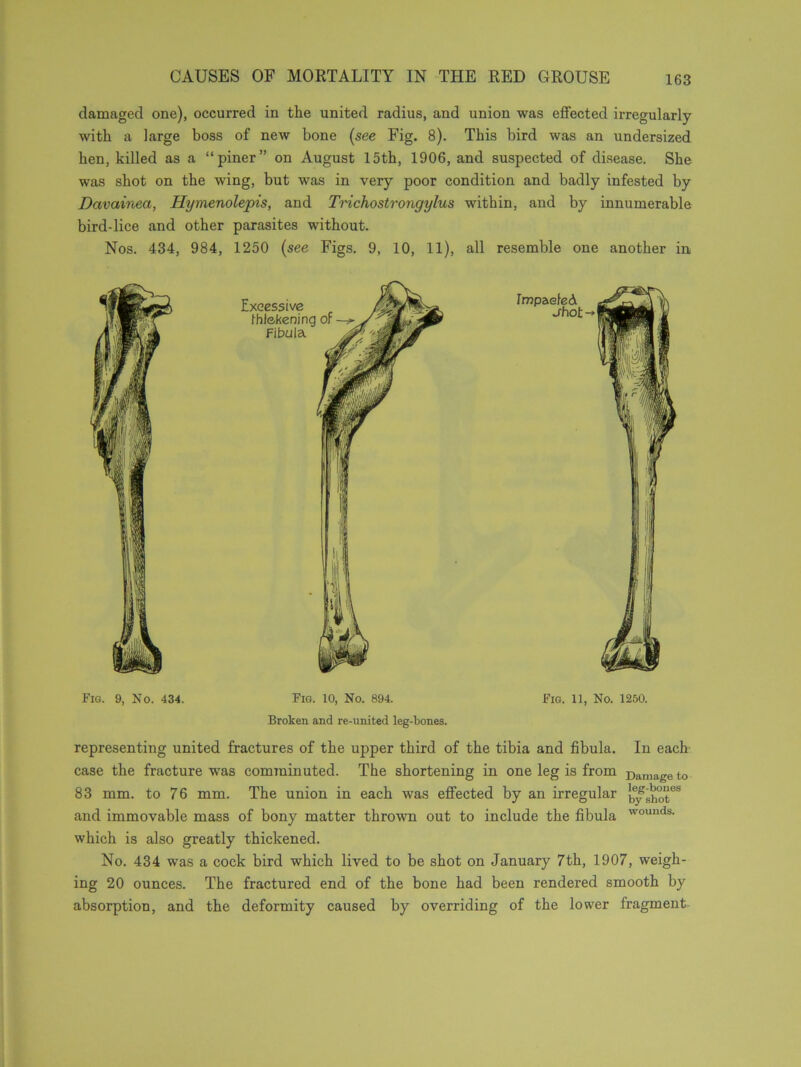 damaged one), occurred in tlie united radius, and union was effected irregularly with a large boss of new bone (see Fig. 8). This bird was an undersized hen, killed as a “piner” on August 15th, 1906, and suspected of disease. She was shot on the wing, but was in very poor condition and badly infested by Dctvainea, Hymenolepis, and Trichostrongylus within, and by innumerable bird-lice and other parasites without. Nos. 434, 984, 1250 (see Figs. 9, 10, 11), all resemble one another in Fig. 9, No. 434. Fig. 10, No. 894. Broken and re-united leg-bones. Fig. 11, No. 1250. representing united fractures of the upper third of the tibia and fibula. In each case the fracture was comminuted. The shortening in one leg is from Damaga to 83 mm. to 76 mm. The union in each was effected by an irregular ltysiwteS and immovable mass of bony matter thrown out to include the fibula wouuds- which is also greatly thickened. No. 434 was a cock bird which lived to be shot on January 7th, 1907, weigh- ing 20 ounces. The fractured end of the bone had been rendered smooth by absorption, and the deformity caused by overriding of the lower fragment