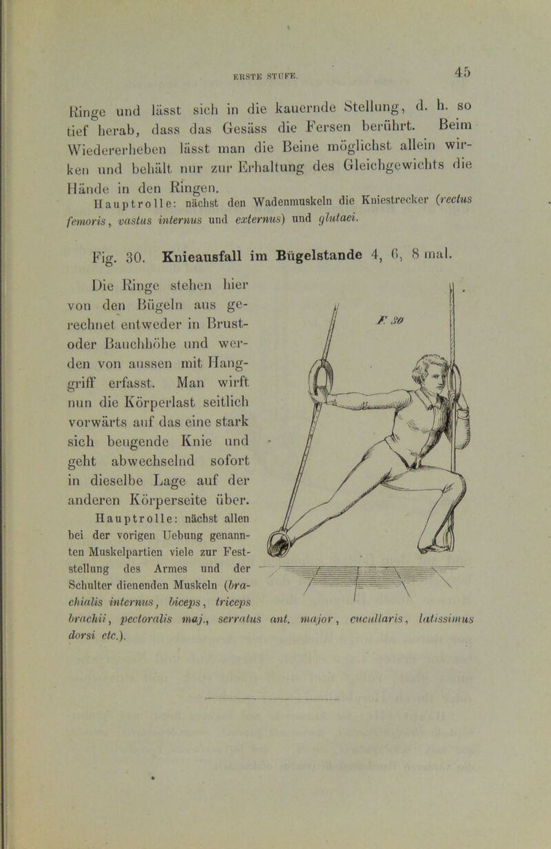 KÜSTE ST [IKK. Kingc und lässt sicli in die kauernde Stellung, d. h. so tief herab, dass das Gesäss die Fersen berührt. Beim Wiederei-heben lässt man die Beine möglichst allein wir- ken und behält nur zur Erhaltung des Gleichgewichts die Hände in den Ringen. Hauptrolle: nächst den Wadenmuskeln die Kniestrecker {rectus femoriSy vastus internus und externus) und (ßutaei. Fig. 30. Knieausfall im Bügelstande 4, (5, 8 mal. Die Ringe stehen hier von den Bügeln aus ge- rechnet entweder in Brust- oder Bauch höhe und wer- den von aussen mit Ilang- griff erfasst. Man wirft nun die Körperlast seitlich vorwärts auf das eine stark sich beugende Knie und geht abwechselnd sofort in dieselbe Lage auf der anderen Körperseite über. Hauptrolle: nächst allen bei der vorigen Hebung genann- ten Muskelpartien viele zur Fest- stellung des Armes und der - Schulter dienenden Muskeln {hra- chinlis internus, biceps, triccps hrnchii, pectoralis maj., serrutus dnrsi etc.). ant. major, cncuUaris, laiissiinus