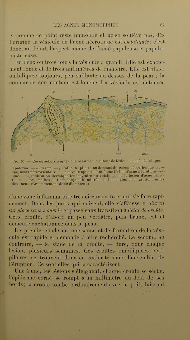 et comme ce point reste immobile et ne se soulève pas, dès l'origine la vésicule de l’acné nécrotique est ombiliquée', c’est donc, au début, l’aspect même de l’acné papuleuse et papulo- pustuleuse. En deux ou trois jours la vésicule a grandi. Elle est exacte- ment ronde et de trois millimètres de diamètre. Elle est plate, ombiliquée toujours, peu saillante au-dessus de la peau; la couleur de son contenu est louche. La vésicule est entourée es é (l c «H Fig. 55. — Cocon séborrhéique de la peau vague autour de lésions d’acné nécrotique. é, épiderme. — d, derme. — f. follicule pilaire au-dessous du cocon séborrhéique es. — apv, amas péri-vasculaire. — c, croûte appartenant à une lésion d’acné nécrotique voi- sine.— di, infiltration dermique leucocytaire au voisinage de la lésion d’acné nécro- tique. — mtc, mailles du tissu conjonctif infiltrées de leucocytes en migration qui les dessinent. (Grossissement de 60 diamètres.) d’une zone inflammatoire très circonscrite et qui s’efface rapi- dement. Dans les jours qui suivent, elle s’affaisse et durcit surplace sans s ouvrir et passe sans transition à Vétat de croûte. Cette croûte, d’abord un peu verdâtre, puis brune, est et demeure enchatonnée dans la peau. Le premier stade de naissance et de formation de la vési- cule est rapide et demande à être recherché. Le second, au contraire, — le stade de la croûte, — dure, pour chaque lésion, plusieurs semaines. Ces croûtes ombiliquées péri- pilaires se trouvent donc en majorité dans E ensemble de l’éruption. Ce sont elles qui la caractérisent. I ne à une, les lésions s’éteignent, chaque croûte se sèche, l’épiderme corné se rompt à un millimètre au delà de ses bords; la croûte tombe, ordinairement avec le poil, laissant G***