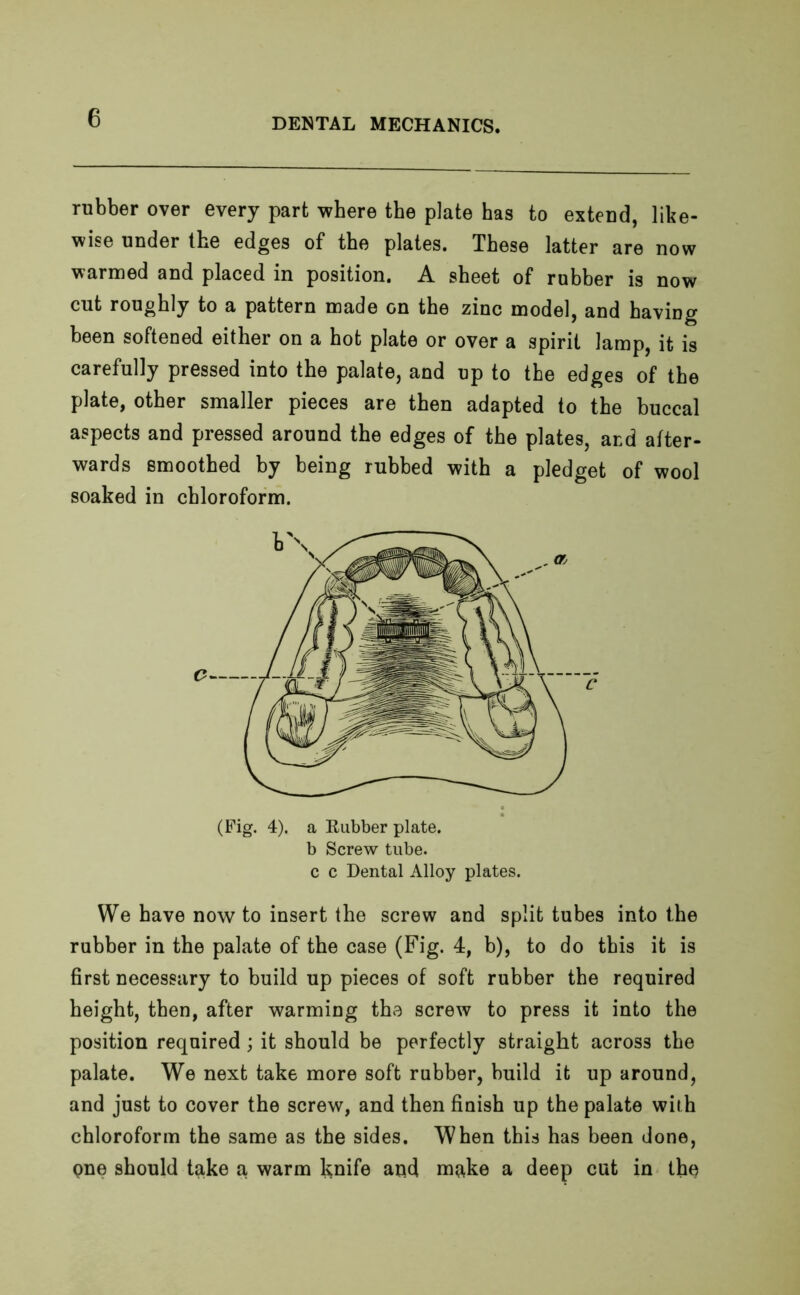 rubber over every part where the plate has to extend, like- wise under the edges of the plates. These latter are now warmed and placed in position. A sheet of rubber is now cut roughly to a pattern made on the zinc model, and having been softened either on a hot plate or over a spirit lamp, it is carefully pressed into the palate, and up to the edges of the plate, other smaller pieces are then adapted to the buccal aspects and pressed around the edges of the plates, and after- wards smoothed by being rubbed with a pledget of wool soaked in chloroform. (Fig. 4). a Rubber plate. b Screw tube, c c Dental Alloy plates. We have now to insert the screw and split tubes into the rubber in the palate of the case (Fig. 4, b), to do this it is first necessary to build up pieces of soft rubber the required height, then, after warming the screw to press it into the position required; it should be perfectly straight across the palate. We next take more soft rubber, build it up around, and just to cover the screw, and then finish up the palate with chloroform the same as the sides. When this has been done, one should take a, warm knife and make a deep cut in the