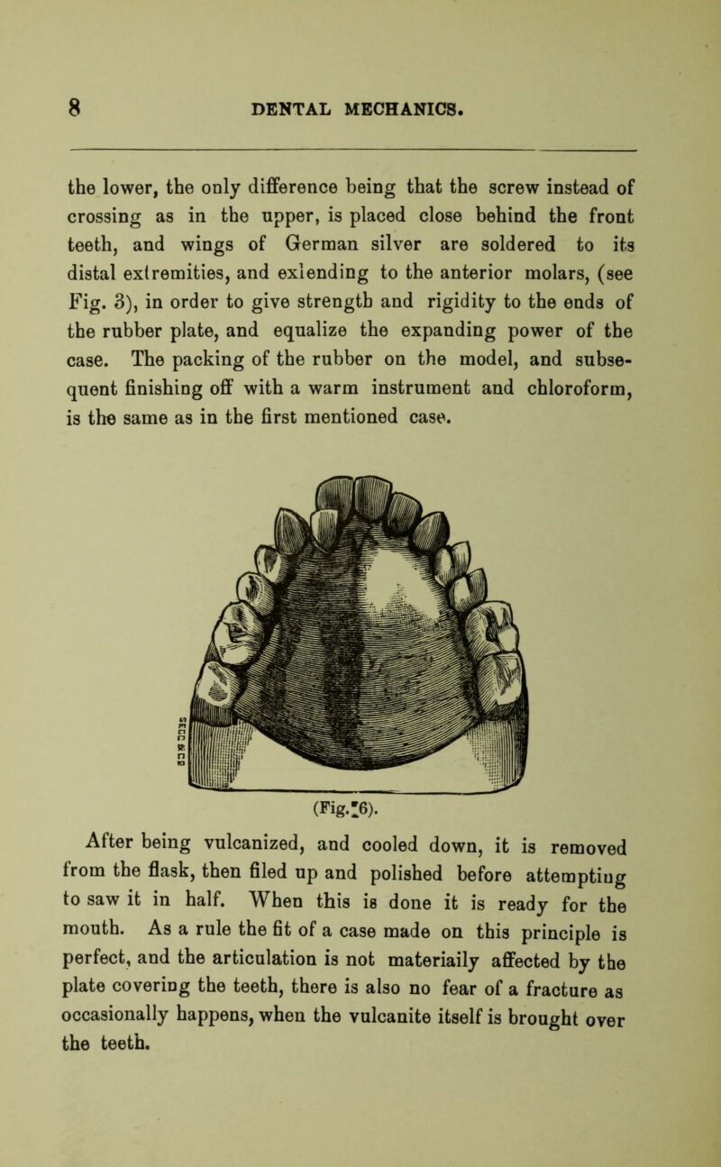 the lower, the only difference being that the screw instead of crossing as in the upper, is placed close behind the front teeth, and wings of German silver are soldered to its distal extremities, and exlending to the anterior molars, (see Fig. 3), in order to give strength and rigidity to the ends of the rubber plate, and equalize the expanding power of the case. The packing of the rubber on the model, and subse- quent finishing off with a warm instrument and chloroform, is the same as in the first mentioned case. (Fig.!6). After being vulcanized, and cooled down, it is removed from the flask, then filed up and polished before attempting to saw it in half. When this is done it is ready for the mouth. As a rule the fit of a case made on this principle is perfect, and the articulation is not materiaily affected by the plate covering the teeth, there is also no fear of a fracture as occasionally happens, when the vulcanite itself is brought over the teeth.