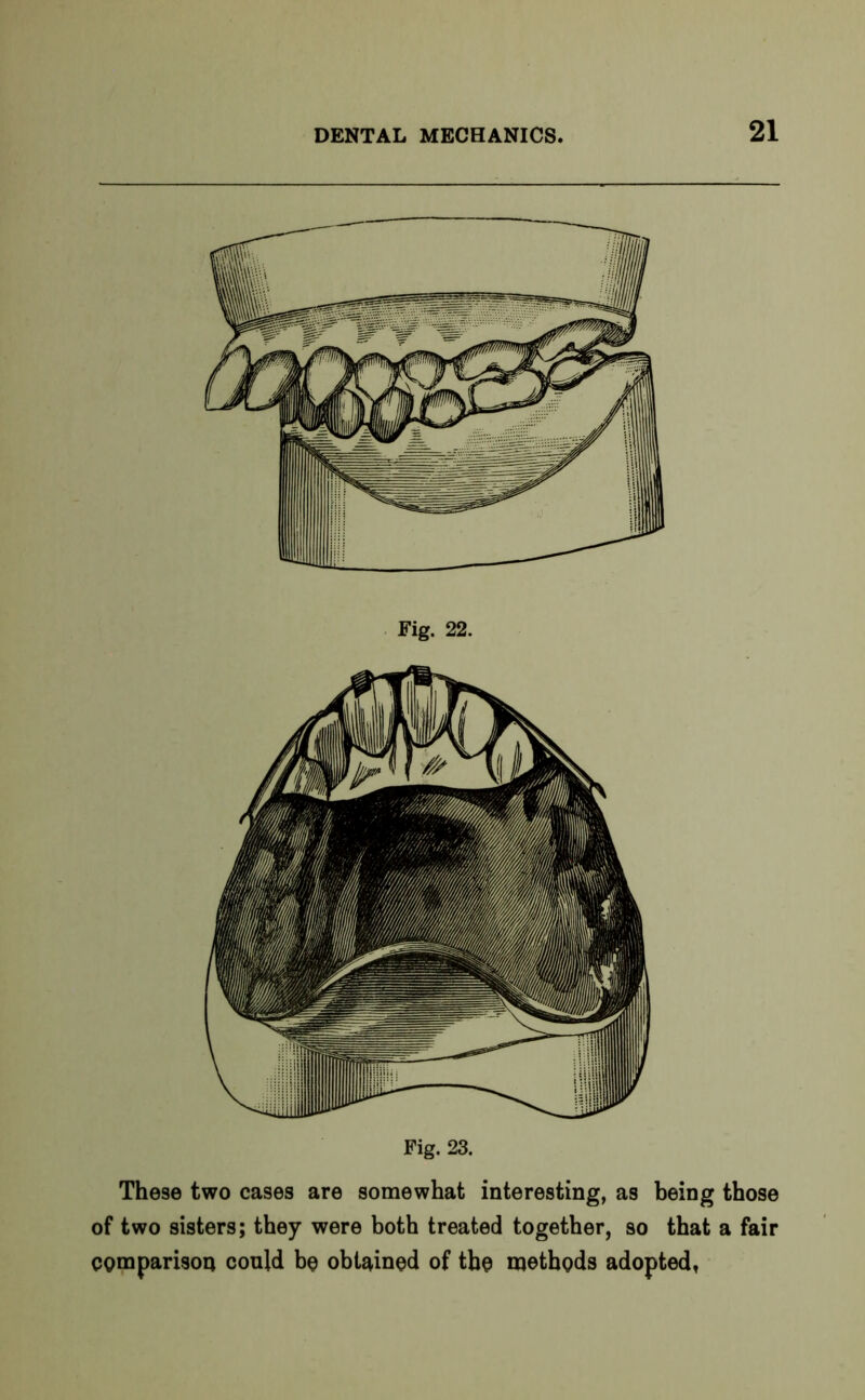 Fig. 22. Fig. 23. These two cases are somewhat interesting, as being those of two sisters; they were both treated together, so that a fair comparison could be obtained of the methods adopted,