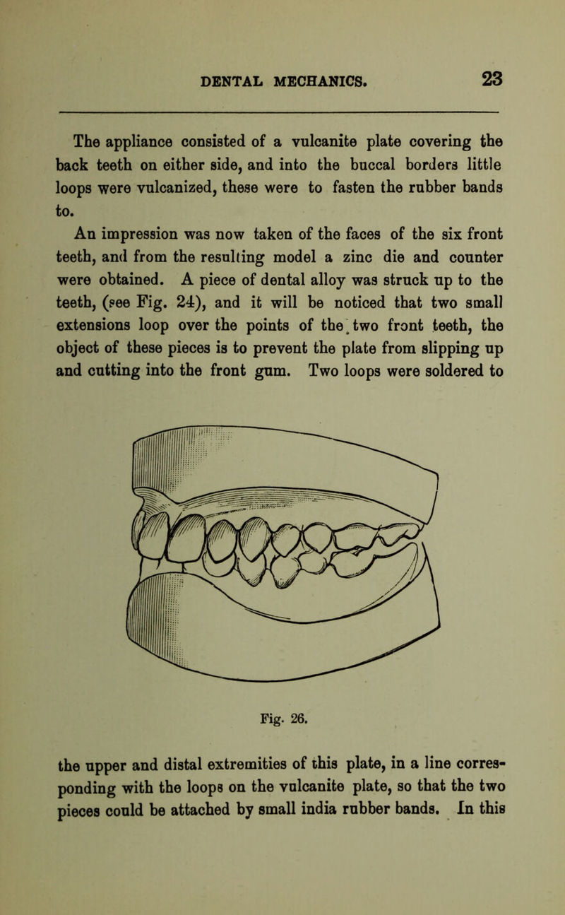 The appliance consisted of a vulcanite plate covering the back teeth on either side, and into the buccal borders little loops were vulcanized, these were to fasten the rubber bands to. An impression was now taken of the faces of the six front teeth, and from the resulting model a zinc die and counter were obtained. A piece of dental alloy was struck up to the teeth, (see Fig. 24), and it will be noticed that two small extensions loop over the points of the t two front teeth, the object of these pieces is to prevent the plate from slipping up and cutting into the front gum. Two loops were soldered to the upper and distal extremities of this plate, in a line corres- ponding with the loops on the vulcanite plate, so that the two pieces could be attached by small india rubber bands. In this