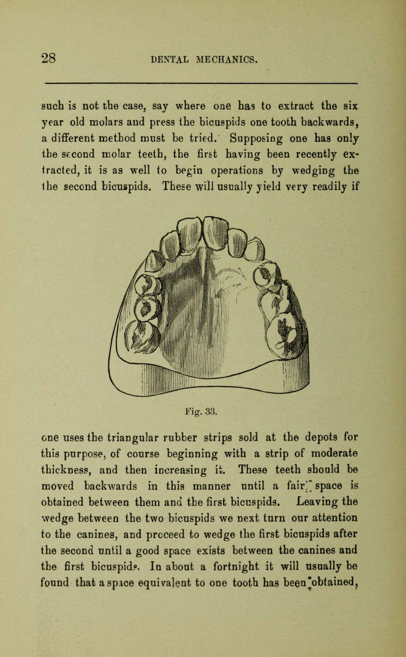 such is not the case, say where one has to extract the six year old molars and press the bicuspids one tooth backwards, a different method must be tried. Supposing one has only the second molar teeth, the first having been recently ex- tracted, it is as well to begin operations by wedging the the second bicuspids. These will usually yield very readily if Fig. 33. one uses the triangular rubber strips sold at the depots for this purpose, of course beginning with a strip of moderate thickness, and then increasing it. These teeth should be moved backwards in this manner until a fair^ space is obtained between them and the first bicuspids. Leaving the wedge between the two bicuspids we next turn our attention to the canines, and proceed to wedge the first bicuspids after the second until a good space exists between the canines and the first bicuspid®. In about a fortnight it will usually be found that a space equivalent to one tooth has been’obtained ?