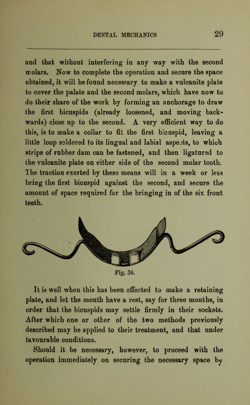 and that without interfering in any way with the second molars. Now to complete the operation and secure the space obtained, it will be found necessary to make a vulcanite plate to cover the palate and the second molars, which have now to do their share of the work by forming an anchorage to draw the first bicuspids (already loosened, and moving back- wards) close up to the second. A very efficient way to do this, is to make a collar to fit the first bicuspid, leaving a little loop soldered to its lingual and labial aspects, to which strips of rubber dam can be fastened, and then ligatured to the vulcanite plate on either side of the second molar tooth. The traction exerted by these means will in a week or less bring the first bicuspid against the second, and secure the amount of space required for the bringing in of the six front teeth. Fig. 34. It is well when this has been effected to make a retaining plate, and let the mouth have a rest, say for three months, in order that the bicuspids may settle firmly in their sockets. After which one or other of the two methods previously described may be applied to their treatment, and that under favourable conditions. Should it be necessary, however, to proceed with the operation immediately on securing the necessary space by