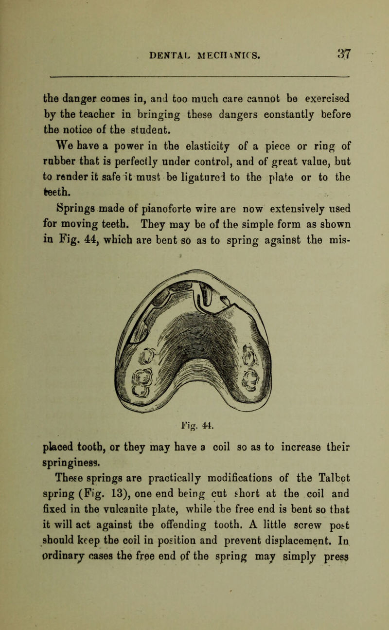 the danger comes in, and too much care cannot be exercised by the teacher in bringing these dangers constantly before the notice of the student. We have a power in the elasticity of a piece or ring of rubber that is perfectly under control, and of great value, but to render it safe it must be ligatured to the plate or to the teeth. Springs made of pianoforte wire are now extensively used for moving teeth. They may be of the simple form as shown in Fig. 44, which are bent so as to spring against the mis- Fig. 44. placed tooth, or they may have a coil so as to increase their springiness. These springs are practically modifications of the Talbot spring (Fig. 13), one end being cut short at the coil and fixed in the vulcanite plate, while the free end is bent so that it will act against the offending tooth. A little screw post should keep the coil in position and prevent displacement. In Ordinary cases the free end of the spring may simply press