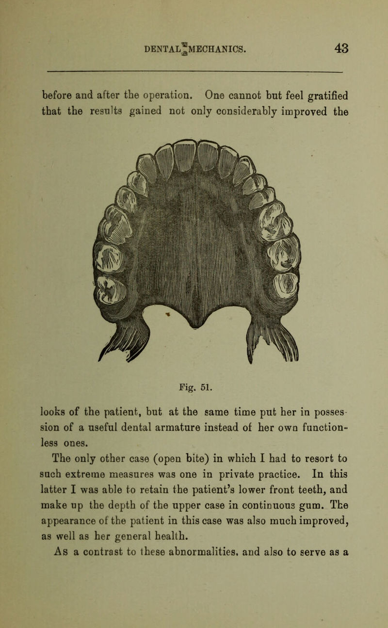 before and after the operation. One cannot but feel gratified that the results gained not only considerably improved the Fig. 51. looks of the patient, but at the same time put her in posses sion of a useful dental armature instead of her own function- less ones. The only other case (open bite) in which I had to resort to such extreme measures was one in private practice. In this latter I was able to retain the patient’s lower front teeth, and make up the depth of the upper case in continuous gum. The appearance of the patient in this case was also much improved, as well as her general health. As a contrast to these abnormalities, and also to serve as a