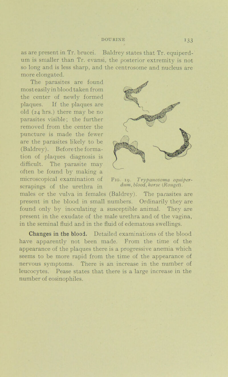 DOURINE *33 as are present in Tr. brucei. Baldrey states that Tr. equiperd- um is smaller than Tr. evansi, the posterior extremity is not so long and is less sharp, and the centrosome and nucleus are more elongated. The parasites are found most easily in blood taken from the center of newly formed plaques. If the plaques are old (24 hrs.) there may be no parasites visible; the further removed from the center the puncture is made the fewer are the parasites likely to be (Baldrey). Before the forma- tion of plaques diagnosis is difficult. The parasite may often be found by making a microscopical examination of scrapings of the urethra in males or the vulva in females (Baldrey). The parasites are present in the blood in small numbers. Ordinarily they are found only by inoculating a susceptible animal. They are present in the exudate of the male urethra and of the vagina, in the seminal fluid and in the fluid of edematous swellings. Fig. 19. Trypanosoma equiper- dum, blood, horse (Rouget). Changes in the blood. Detailed examinations of the blood have apparently not been made. From the time of the appearance of the plaques there is a progressive anemia which seems to be more rapid from the time of the appearance of nervous symptoms. There is an increase in the number of leucocytes. Pease states that there is a large increase in the number of eosinophiles.