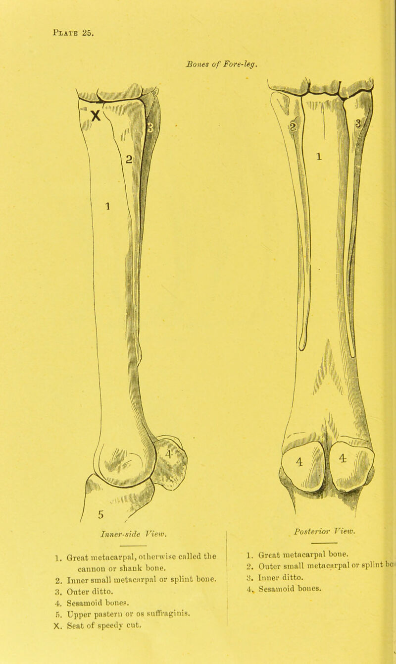 Bones of Fore-leg. Inner-side View. Posterior View. 1. Great metacarpal, otherwise called the cannon or shnuk bone. 2. Inner small metacarpal or splint bone. 3. Outer ditto. 4. Sesamoid bones. 5. Upper pastern or os suffraginis. X. Seat of speedy cut. 1. Great metacarpal bone. 2. Outer small metacarpal or splint bo 3. Inner ditto. 4V Sesamoid bones.