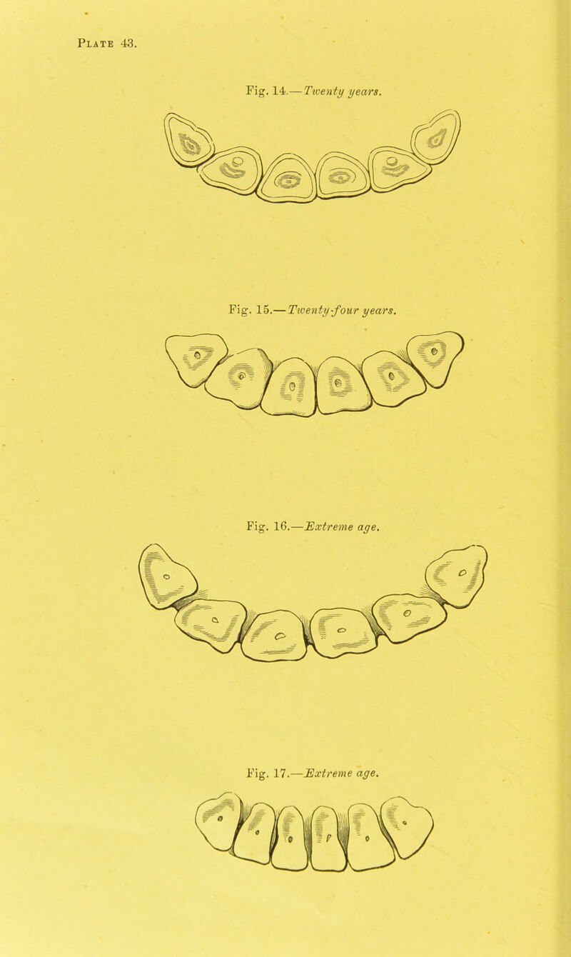 Fig. 14.— Twenty years. Fig. 15.— Twenty-four years. Fig. 16.—'Extreme age. Fig. 17.—Extreme age.