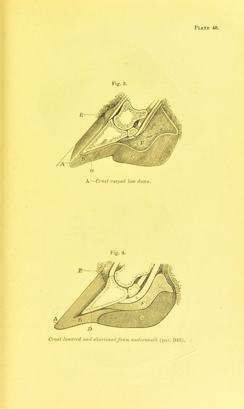 Fig. 3. n A — Crust rasped low down. Fig. 4. Crust lowered and shortened from underneath (par. 946).