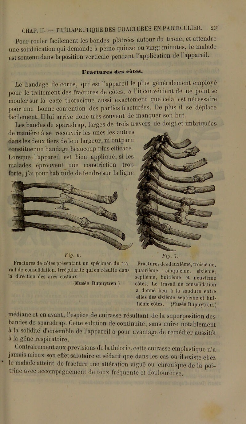 CHAP. II. — THÉRAPEUTIQUE DES FRACTURES EÏN PARTICULIER. rs Pour rouler facilement les bandes plâtrées autour du tronc, et attendre une solidification qui demande à peine quinze ou vingt minutes, le malade est soutenu dans la position verticale pendant l’application de l’appareil. Fractures des côtes. Le bandage de corps, qui est l’appareil le plus généralement employé pour le traitement des fractures de c.ôtes, a l’inconvénient de ne point se mouler sur la cage thoracique aussi exactement que cela est nécessaire pour une bonne contention des parties fracturées. De plus il se déplace facilement. Il lui arrive donc très-souvent de manquer son but. Les bandes de sparadrap, larges de trois travers de doigt et imbriquées de manière à se recouvrir les unes les autres dans les deux tiers de leur largeur, m’ontparu constituer un bandage beaucoup plus efficace. Lorsque l’appareil est bien appliqué, si les malades éprouvent une conslriction trop forte, j’ai pour habitude de fendre sur la ligne Fig. 0. Fig. 7. Fractures de côtes présentant un spécimen du tra- Fractures des deuxième, troisième, vail de consolidation, irrégularité qui en résulte dans quatrième, cinquième, sixième, la direction des arcs costaux. septième, huitième et neuvième (Musée Dupuytren.) côtes. Le travail de consolidation a donné lieu à la soudure entre elles des sixième, septième et hui- tième côtes. (Musée Dupuytren.) médiane et en avant, l’espèce de cuirasse résultant de la superposition des bandes de sparadrap. Cette solution de continuité, sans nuire notablement à la solidité d’ensemble de l’appareil a pour avantage de remédier aussitôt à la gène respiratoire. Contrairement aux prévisions delà théorie,cette cuirasse emplastiquc n’a jamais mieux son effet salutaire et sédatif que dans les cas où il existe chez le malade atteint de fracture une altération aiguë ou chronique de la poi- trine avec accompagnement de toux fréquente et douloureuse.