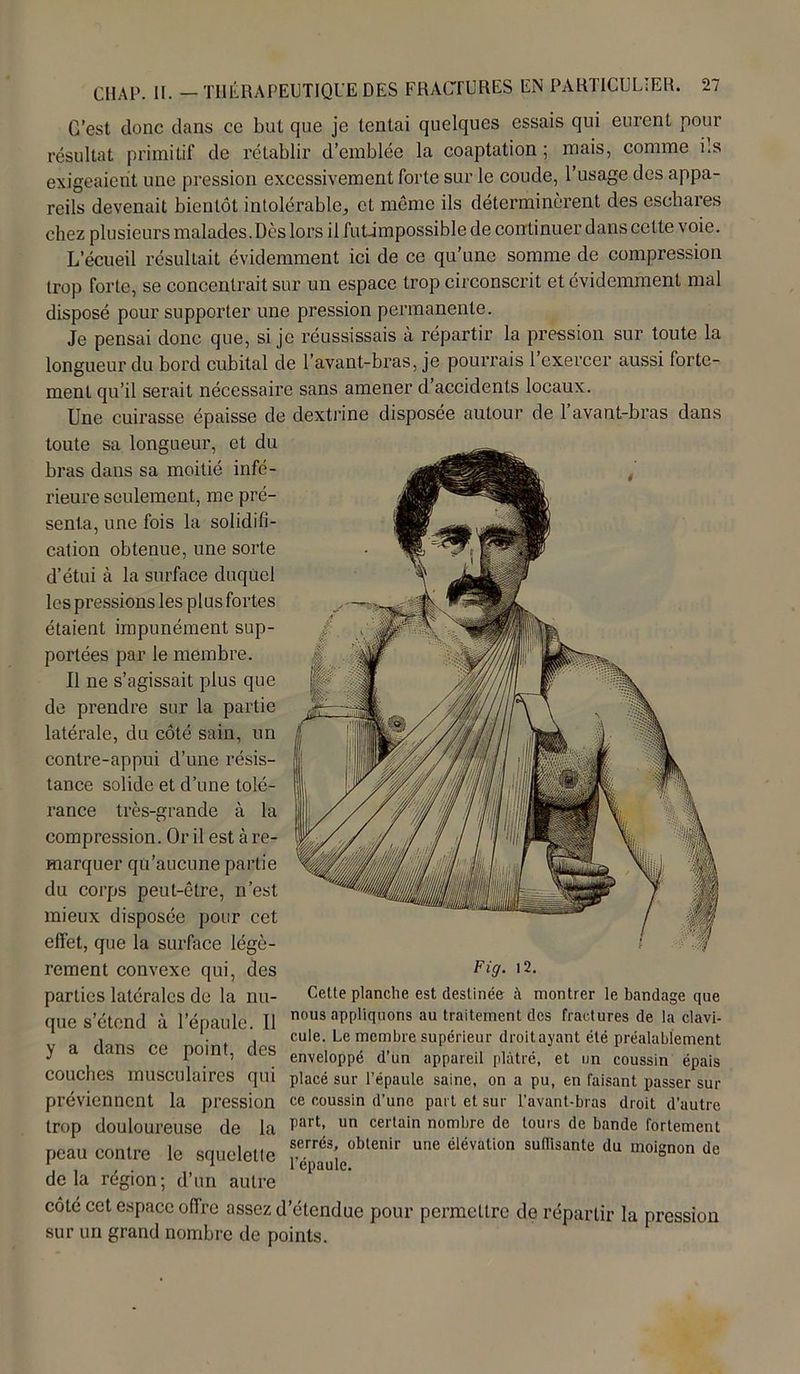 C’est donc dans ce but que je tentai quelques essais qui eurent pour résultat primitif de rétablir d’emblée la coaptation ; mais, comme ils exigeaient une pression excessivement forte sur le coude, l’usage des appa- reils devenait bientôt intolérable, et même ils déterminèrent des eschares chez plusieurs malades.Dès lors il futimpossible de continuer dans celte voie. L’écueil résultait évidemment ici de ce qu’une somme de compression trop forte, se concentrait sur un espace trop circonscrit et évidemment mal disposé pour supporter une pression permanente. Je pensai donc que, si je réussissais à répartir la pression sur toute la longueur du bord cubital de l’avant-bras, je pourrais 1 exercer aussi forte- ment qu’il serait nécessaire sans amener d’accidents locaux. Une cuirasse épaisse de dextrine disposée autour de 1 avant-bras dans toute sa longueur, et du bras dans sa moitié infé- rieure seulement, me pré- senta, une fois la solidifi- cation obtenue, une sorte d’étui à la surface duquel les pressions les plus fortes étaient impunément sup- portées par le membre. Il ne s’agissait plus que de prendre sur la partie latérale, du côté sain, un contre-appui d’une résis- tance solide et d’une tolé- rance très-grande à la compression. Or il est à re- marquer qu’aucune partie du corps peut-être, n’est mieux disposée pour cet effet, que la surface légè- rement convexe qui, des parties latérales de la nu- que s’étend à l’épaule. Il y a dans ce point, des couches musculaires qui préviennent la pression trop douloureuse de la peau contre le squelette delà région; d’un autre côté cet espace offre assez d’étendue pour permettre de répartir la pression sur un grand nombre de points. Fig. l2. Cette planche est destinée à montrer le bandage que nous appliquons au traitement des fractures de la clavi- cule. Le membre supérieur droit ayant été préalablement enveloppé d’un appareil plâtré, et un coussin épais placé sur l’épaule saine, on a pu, en faisant passer sur ce coussin d’une part et sur l’avant-bras droit d’autre part, un certain nombre de tours de bande fortement serrés, obtenir une élévation suffisante du moignon de l’épaule.